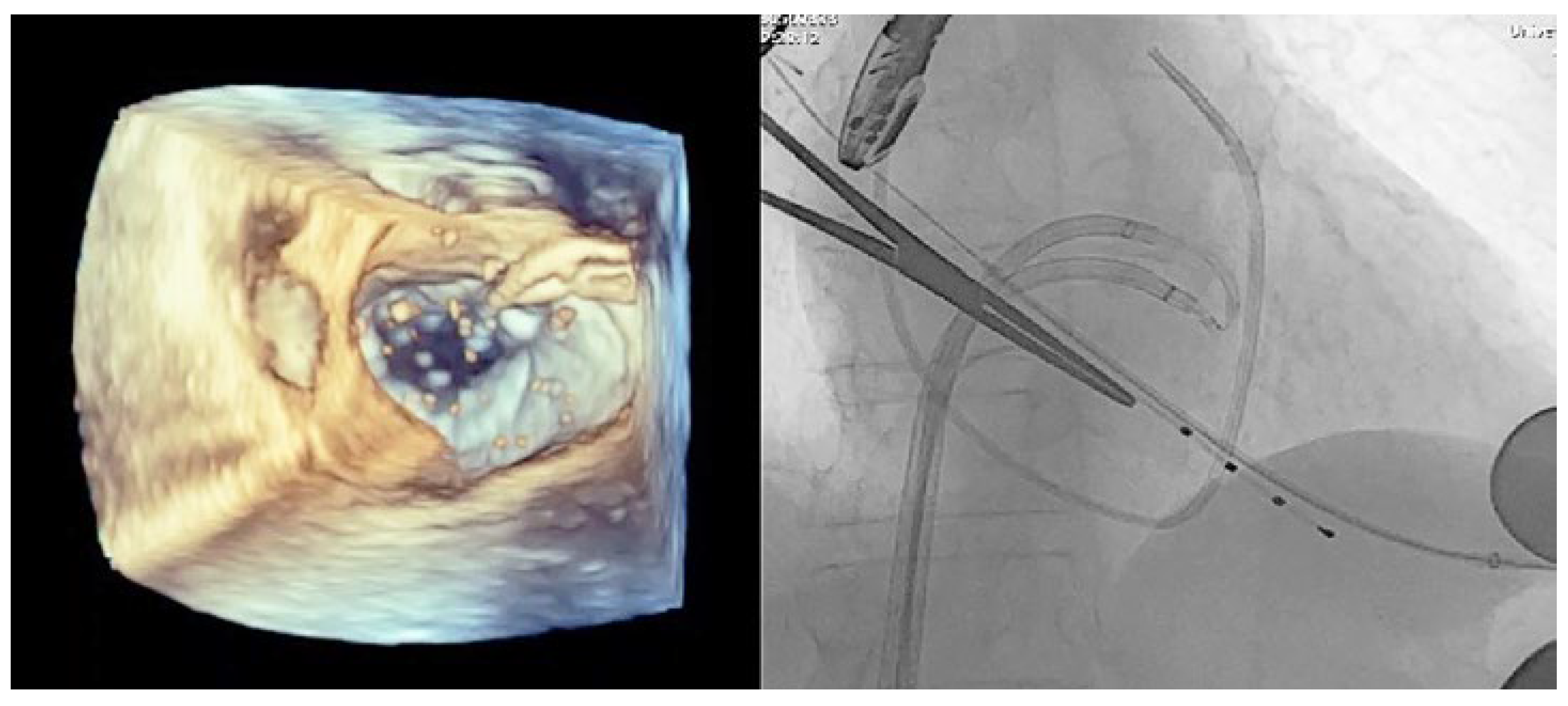 Cardiovascmed 27 00114 g004