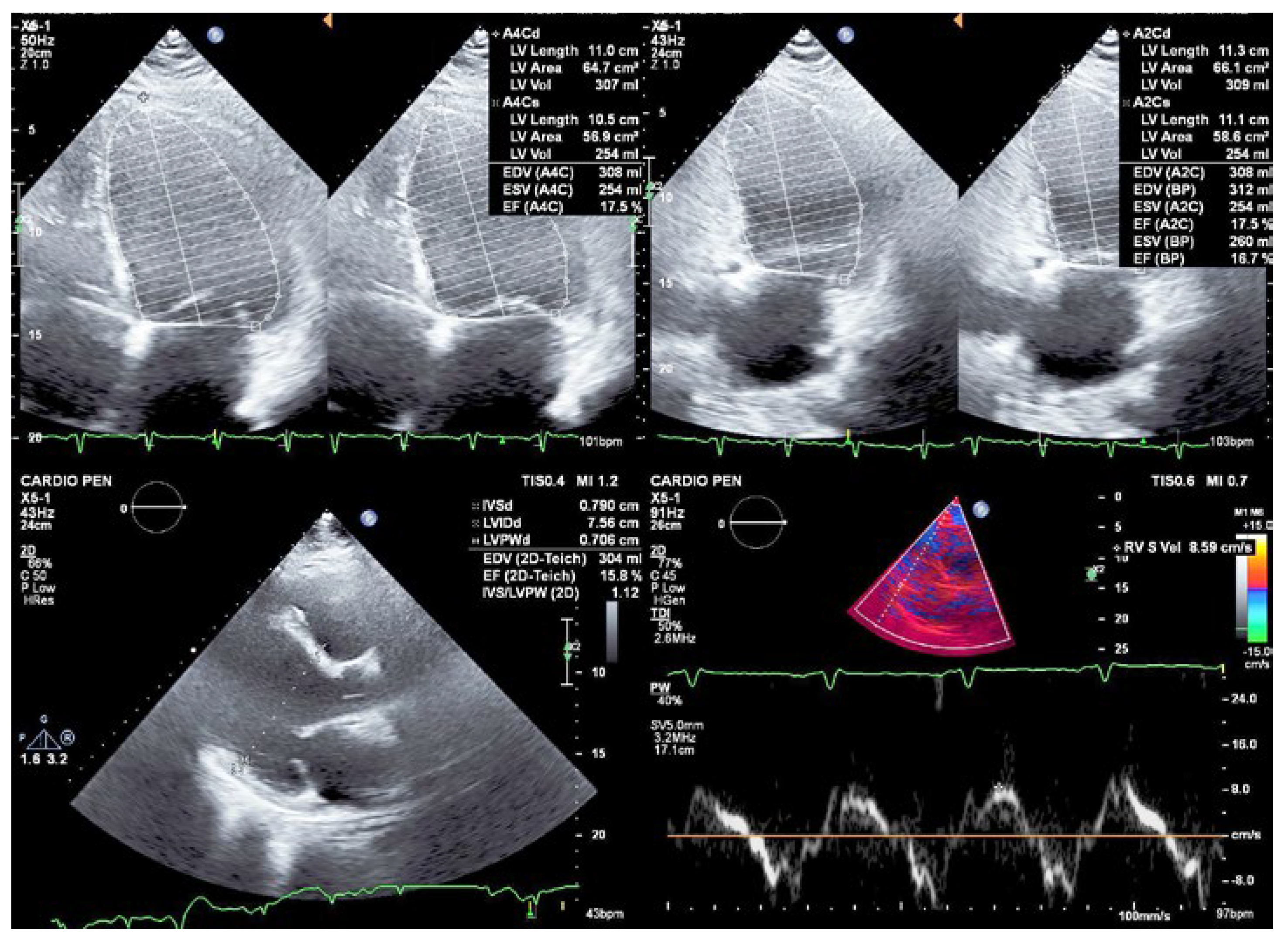 Cardiovascmed 27 00117 g002