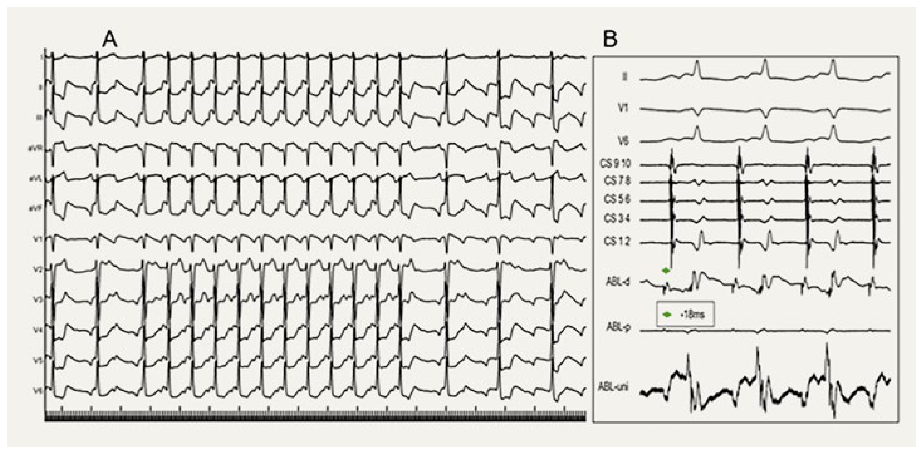 Cardiovascmed 27 00122 g002