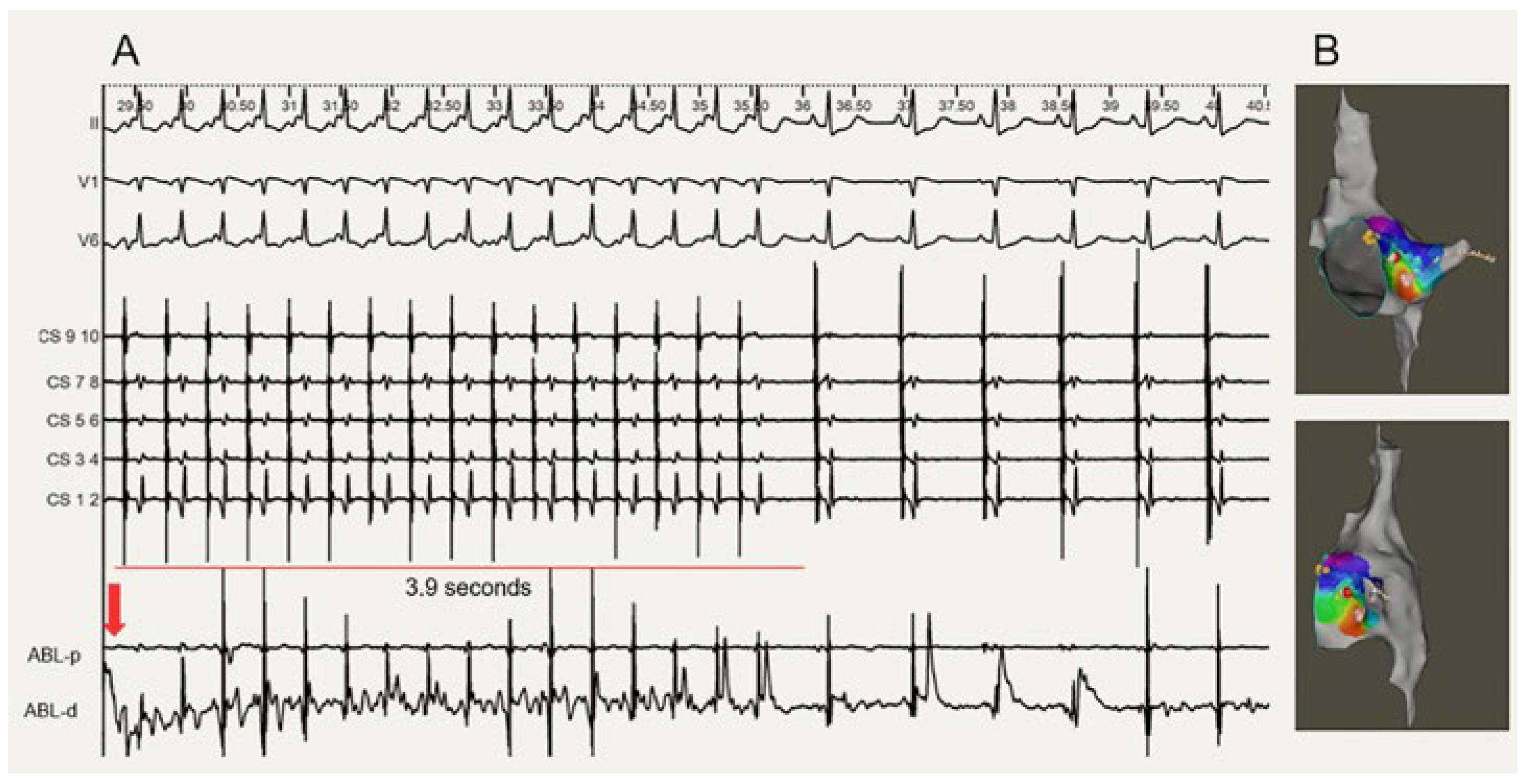 Cardiovascmed 27 00122 g003