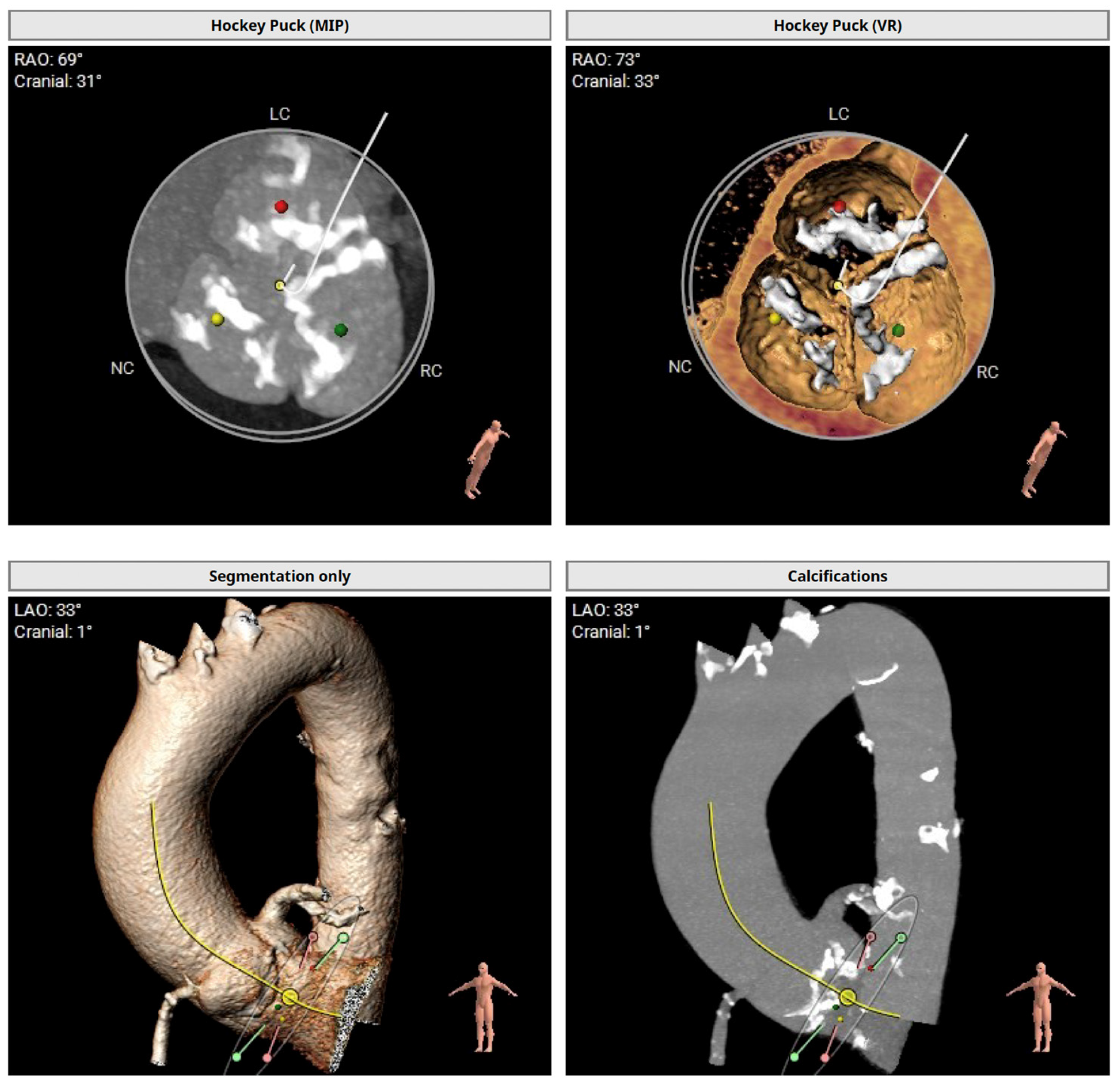 Cardiovascmed 28 00004 g001