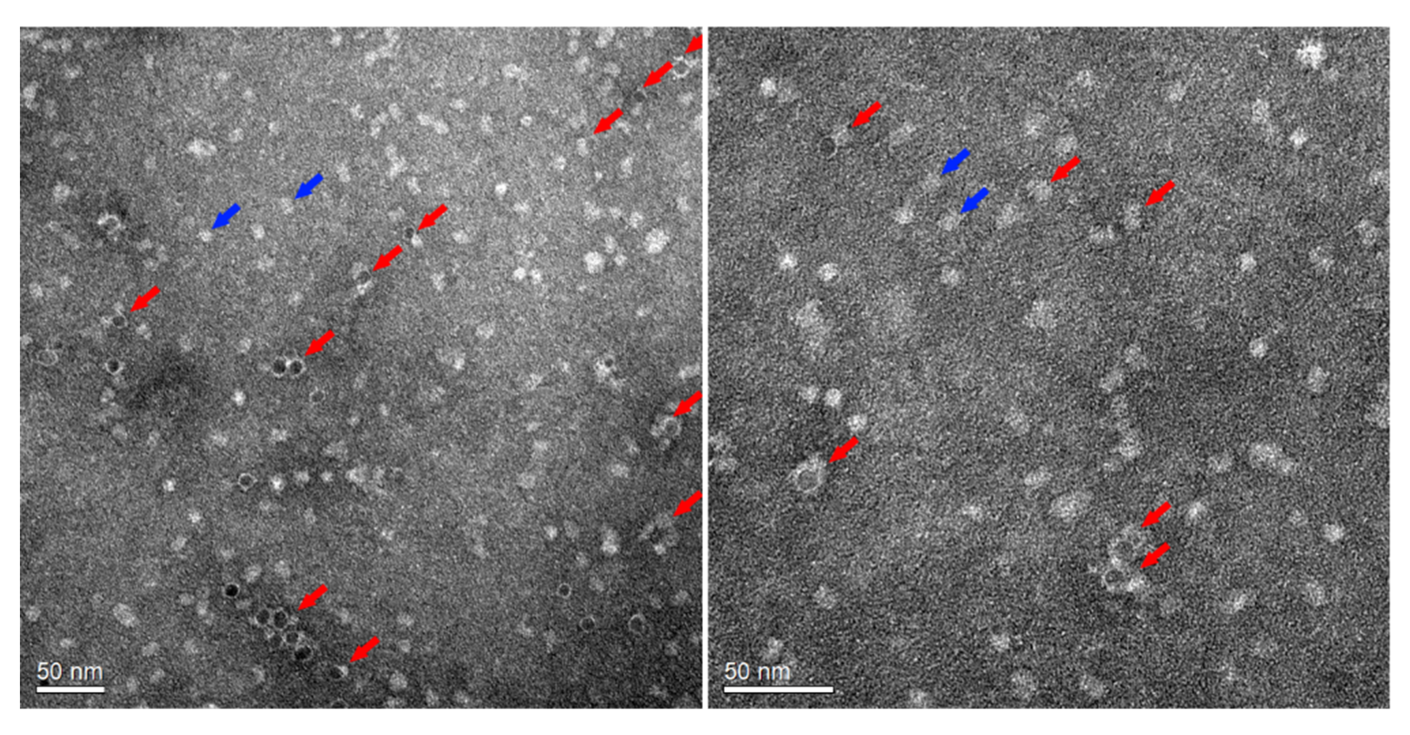 Catalysts 10 00979 g004