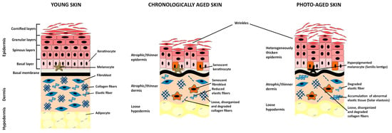 File:501 Structure of the skin.jpg - Wikimedia Commons