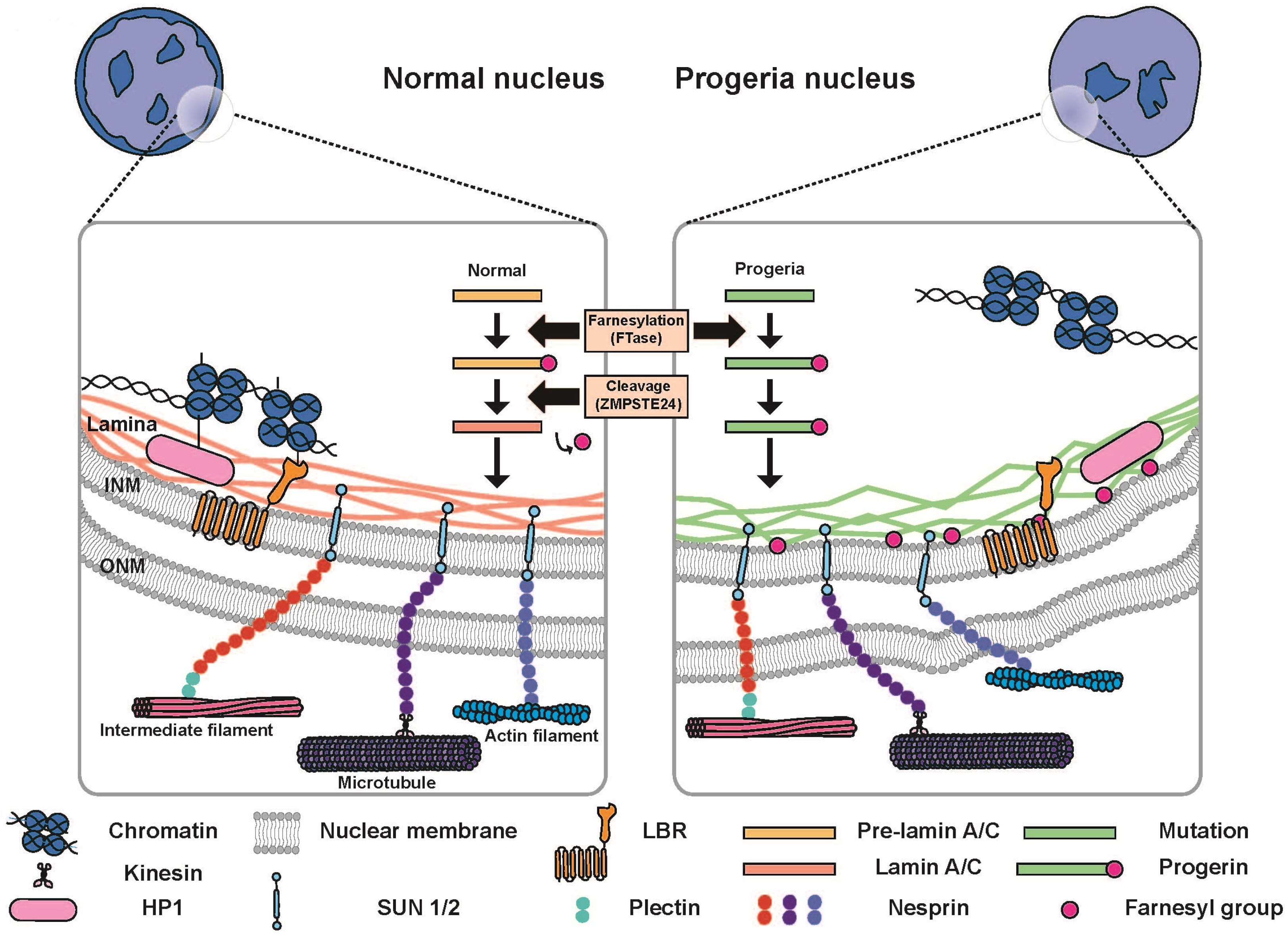 nuclear lamina progeria