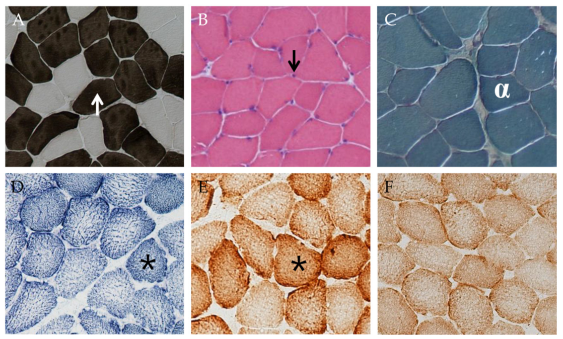 Cells 08 00237 g005 550