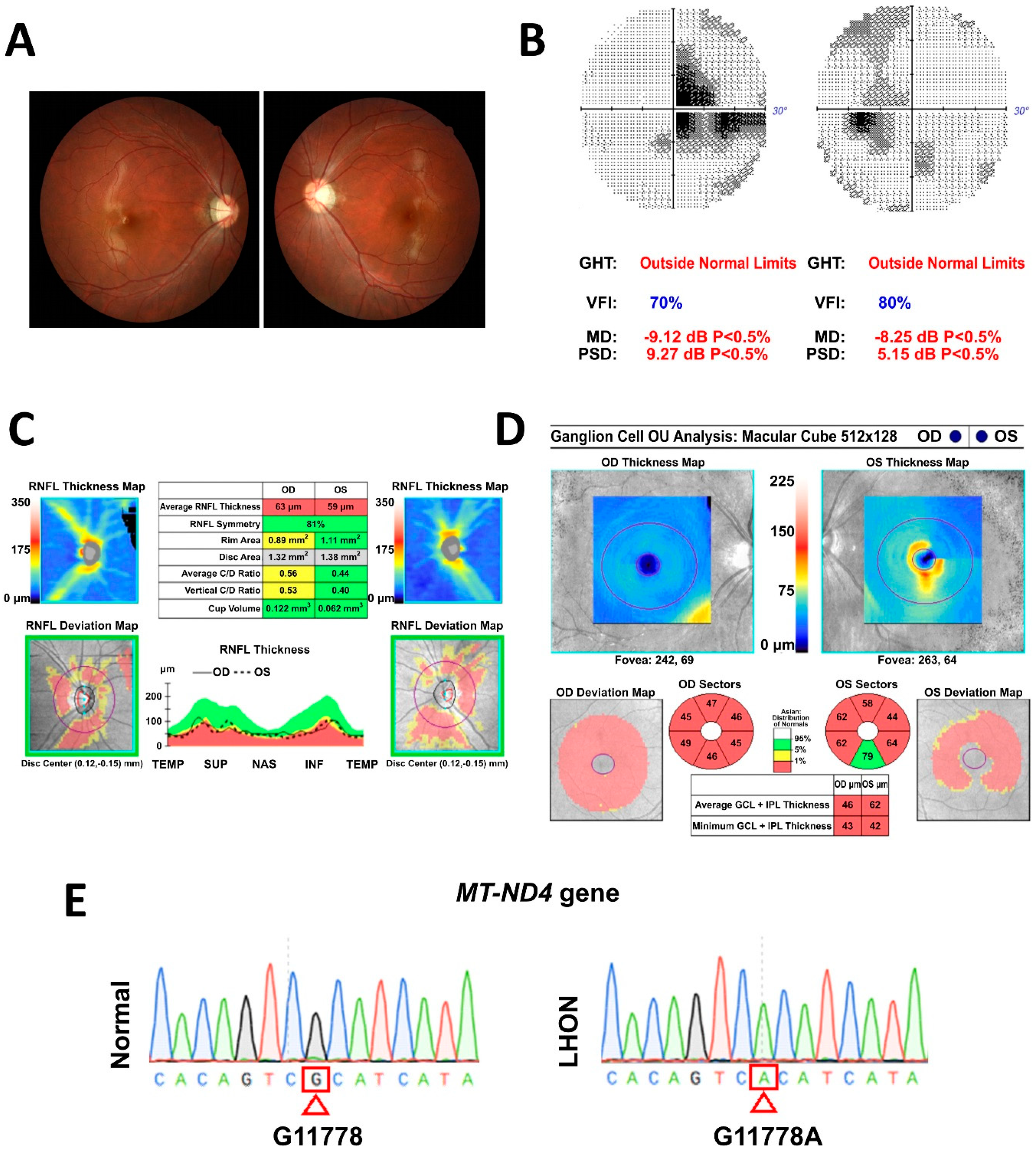 Cells 08 00625 g001 Cells 08 00625 g001
