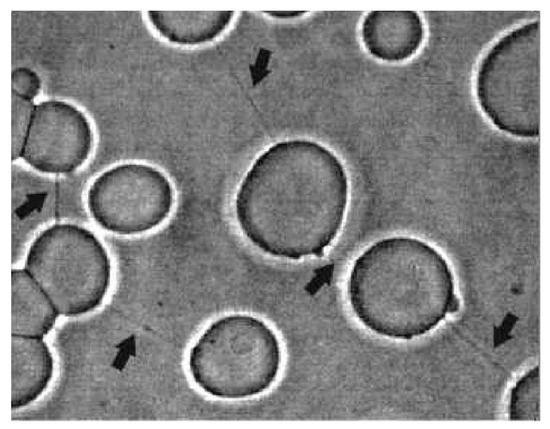 Cells | Special Issue : Frontiers in Cytoskeleton Research—From