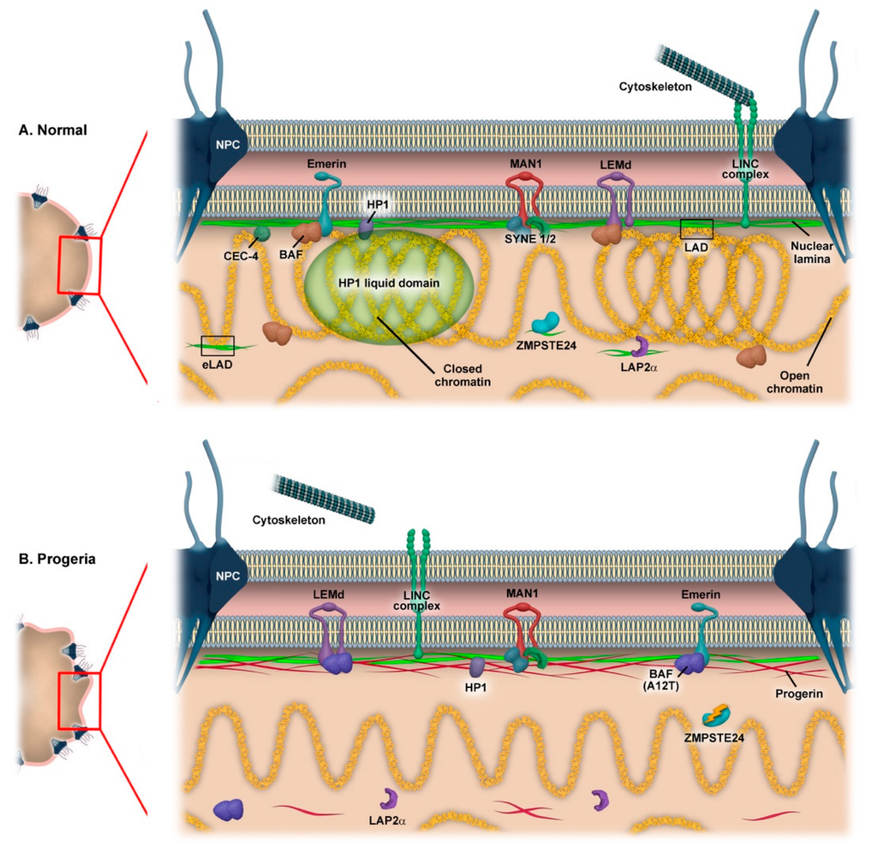 nuclear lamina progeria