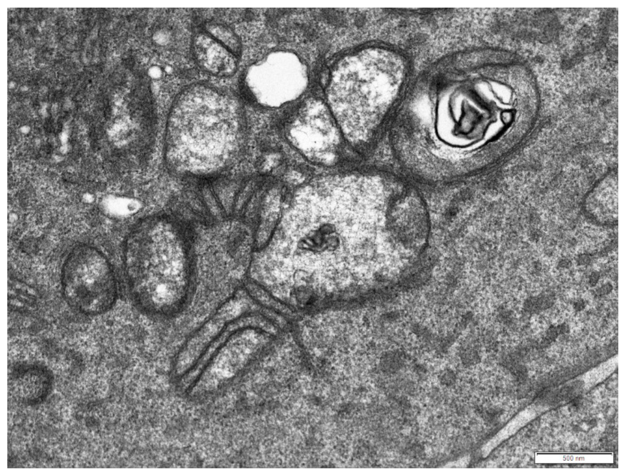 Mitochondrial Homeostasis and Cellular Senescence