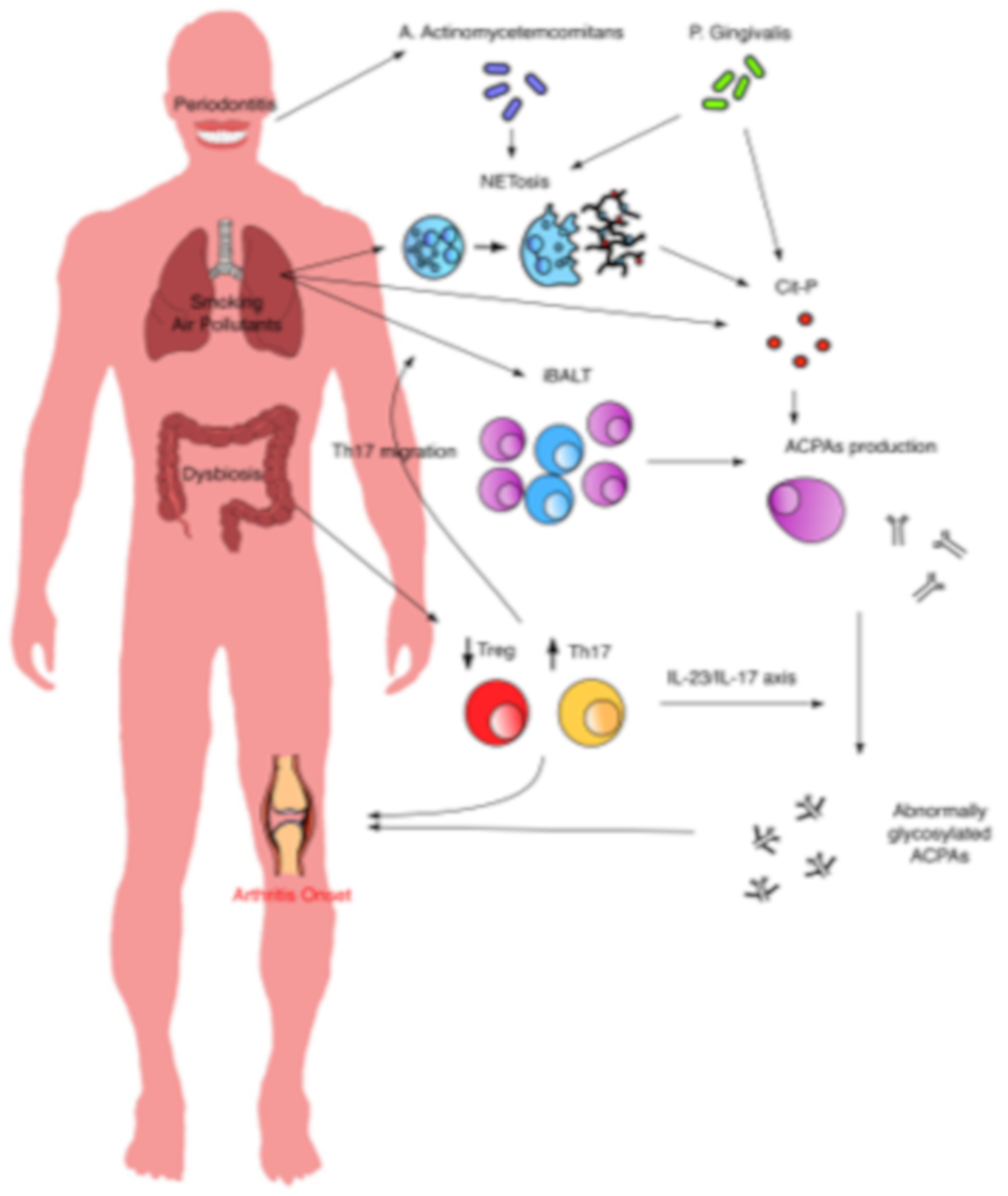 Cells Free Full Text Mucosa Environment Interactions In The Pathogenesis Of Rheumatoid Arthritis Html