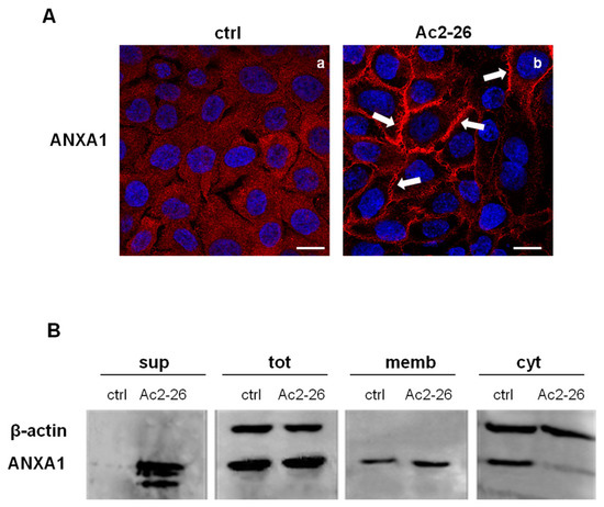 Annexin A1 Contained in Extracellular Vesicles Promotes the