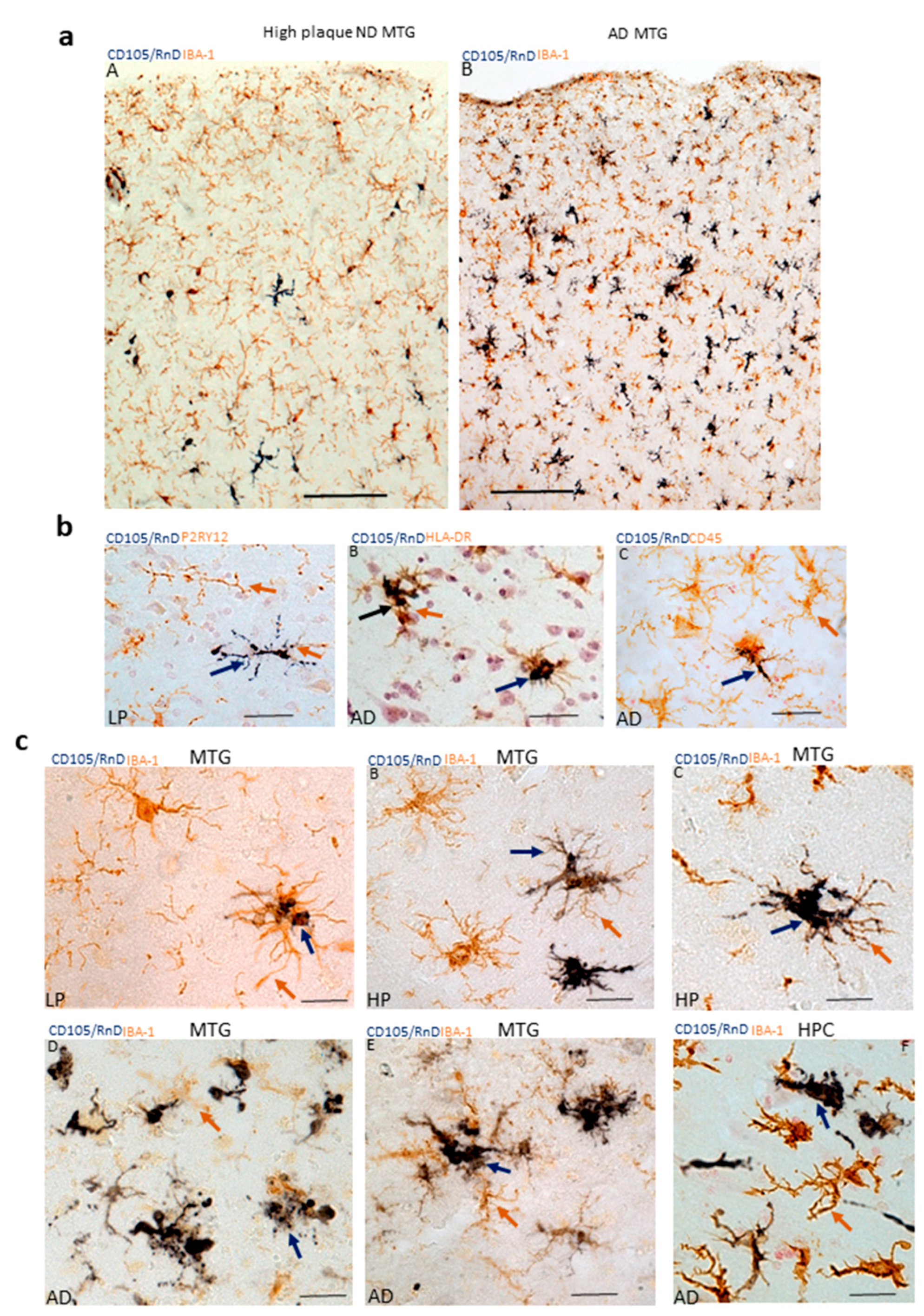 Cells Free Full Text Microglial Phenotyping In Neurodegenerative Disease Brains Identification Of Reactive Microglia With An Antibody To Variant Of Cd105 Endoglin Html
