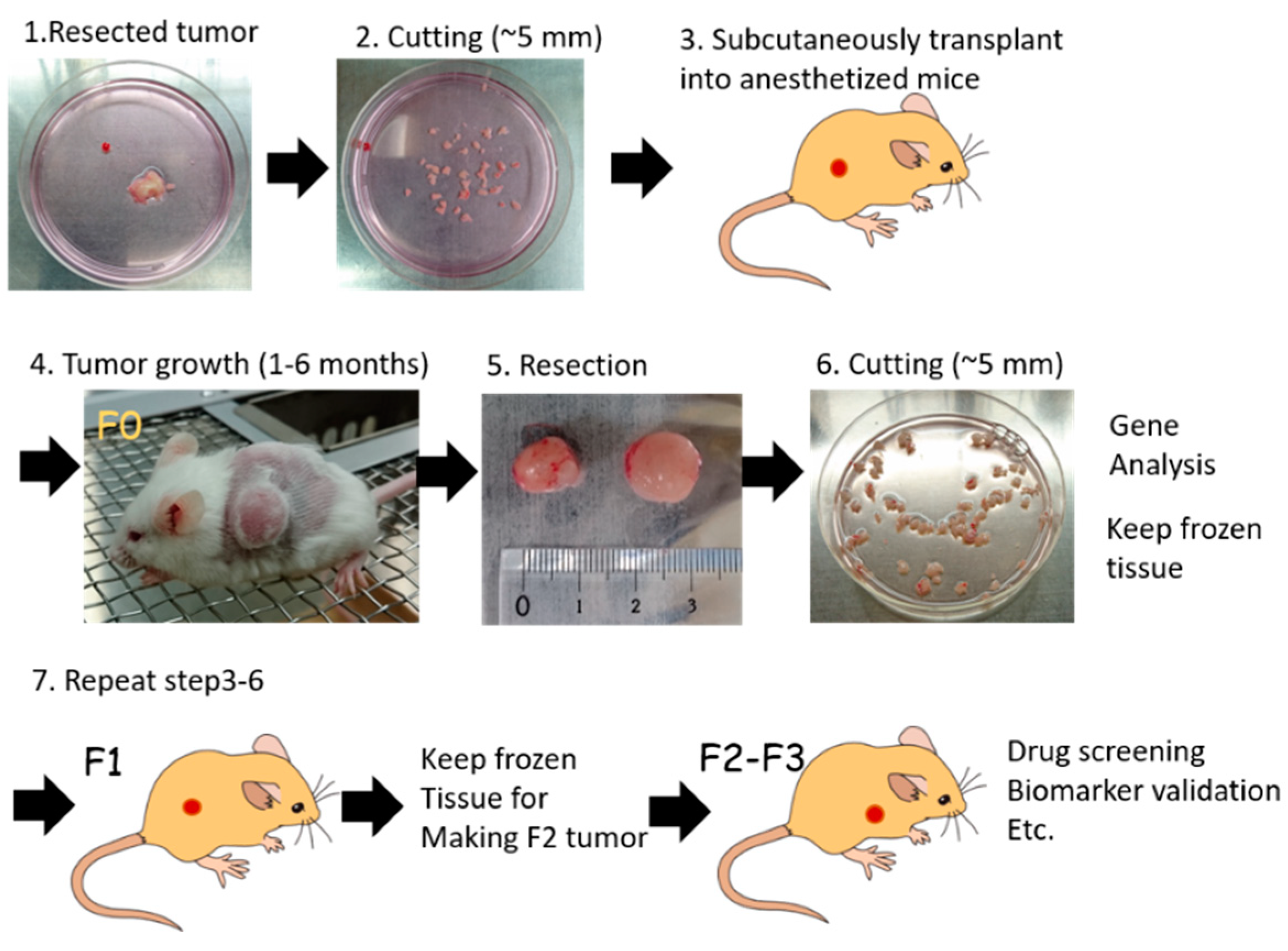 gastric cancer xenograft mouse models