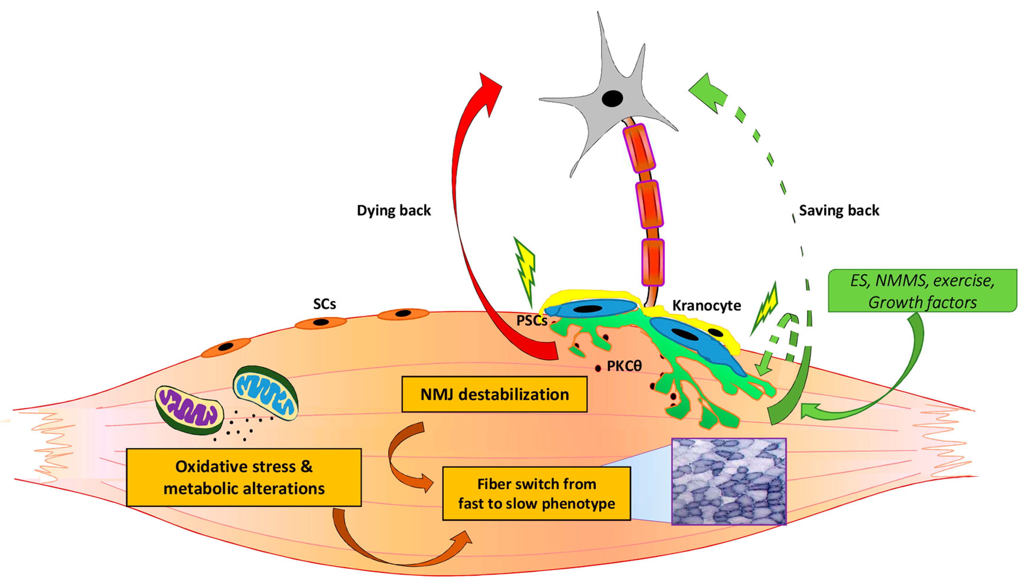 Cells | Free Full-Text | Neuromuscular Junction as an Entity of Nerve