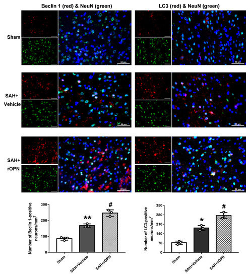 Osteopontin-Enhanced Autophagy Attenuates Early Brain Injury