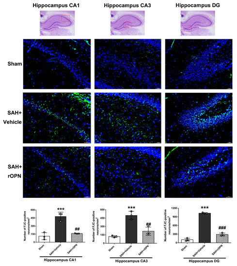 Osteopontin-Enhanced Autophagy Attenuates Early Brain Injury