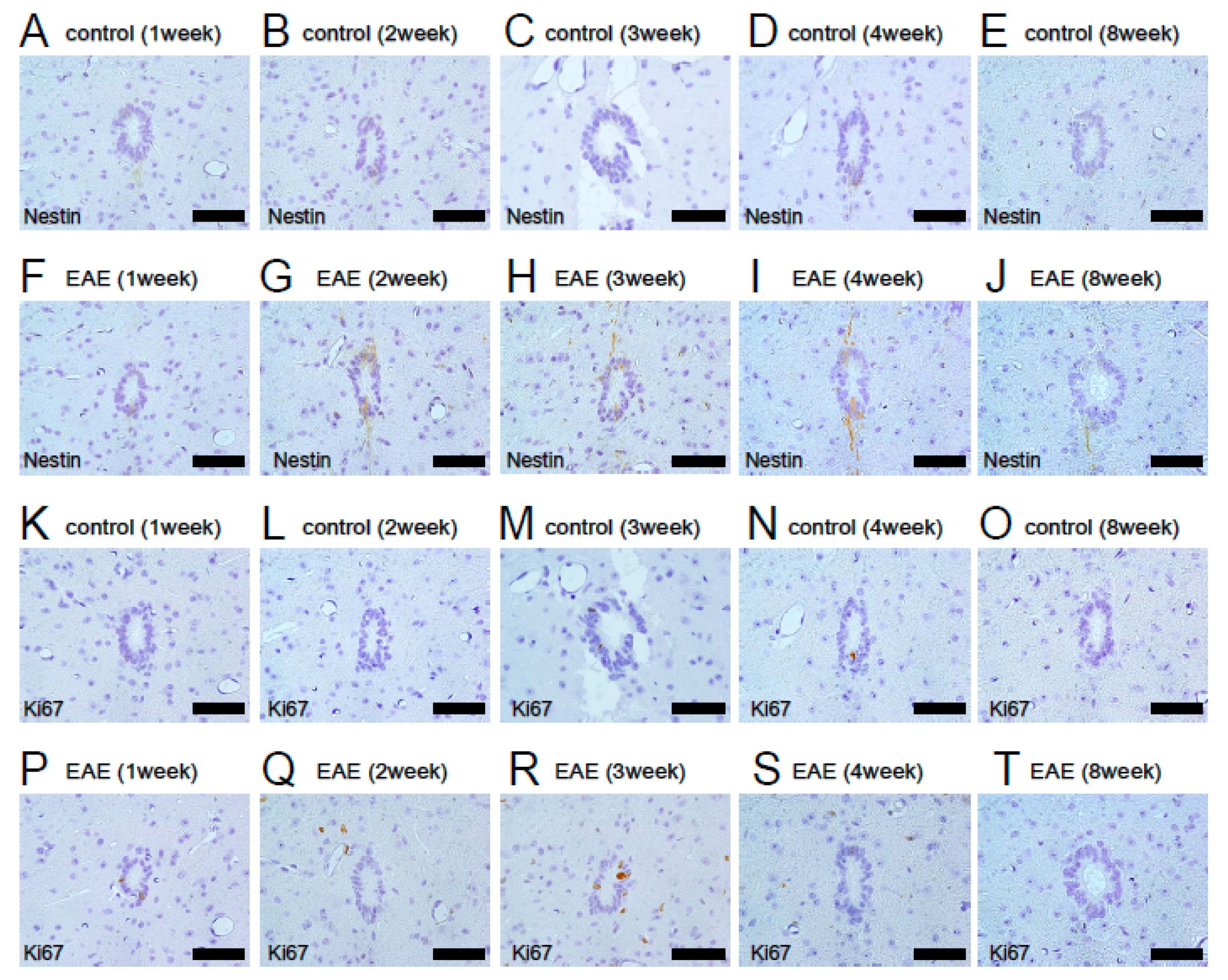 Cells Free Full Text Potential Of Adult Endogenous Neural Stem Progenitor Cells In The Spinal Cord To Contribute To Remyelination In Experimental Autoimmune Encephalomyelitis Html