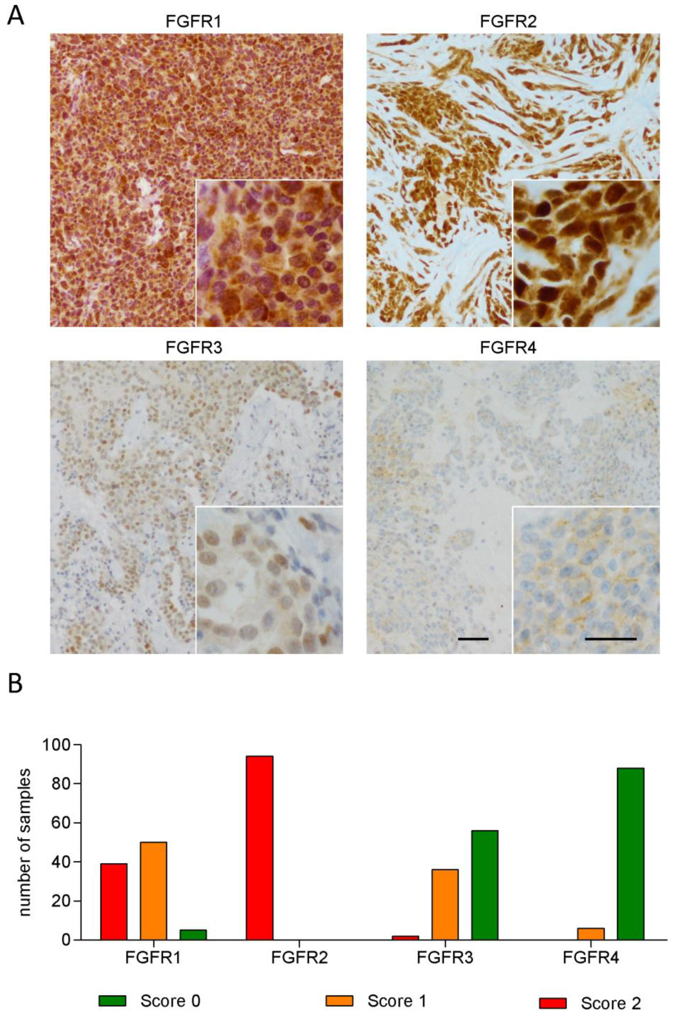 is peritoneal cancer terminal