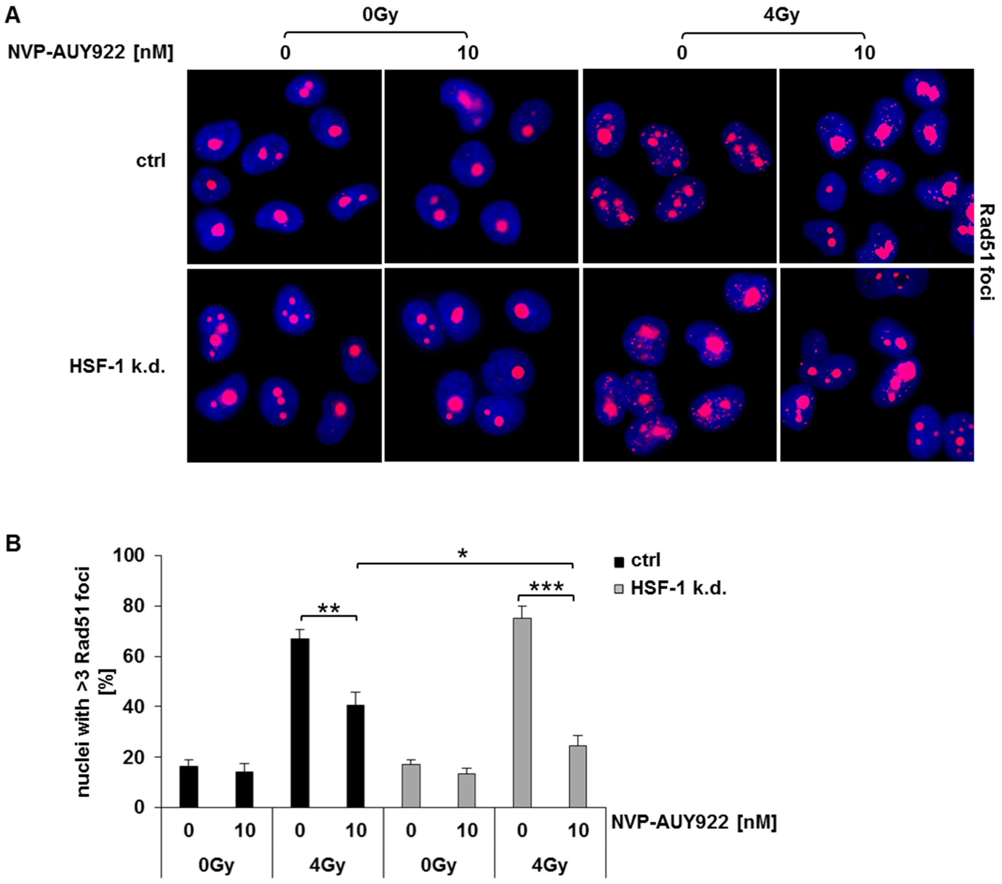 Cells Free Full Text Radiosensitization Of Hsf 1 Knockdown Lung Cancer Cells By Low Concentrations Of Hsp90 Inhibitor Nvp Auy922