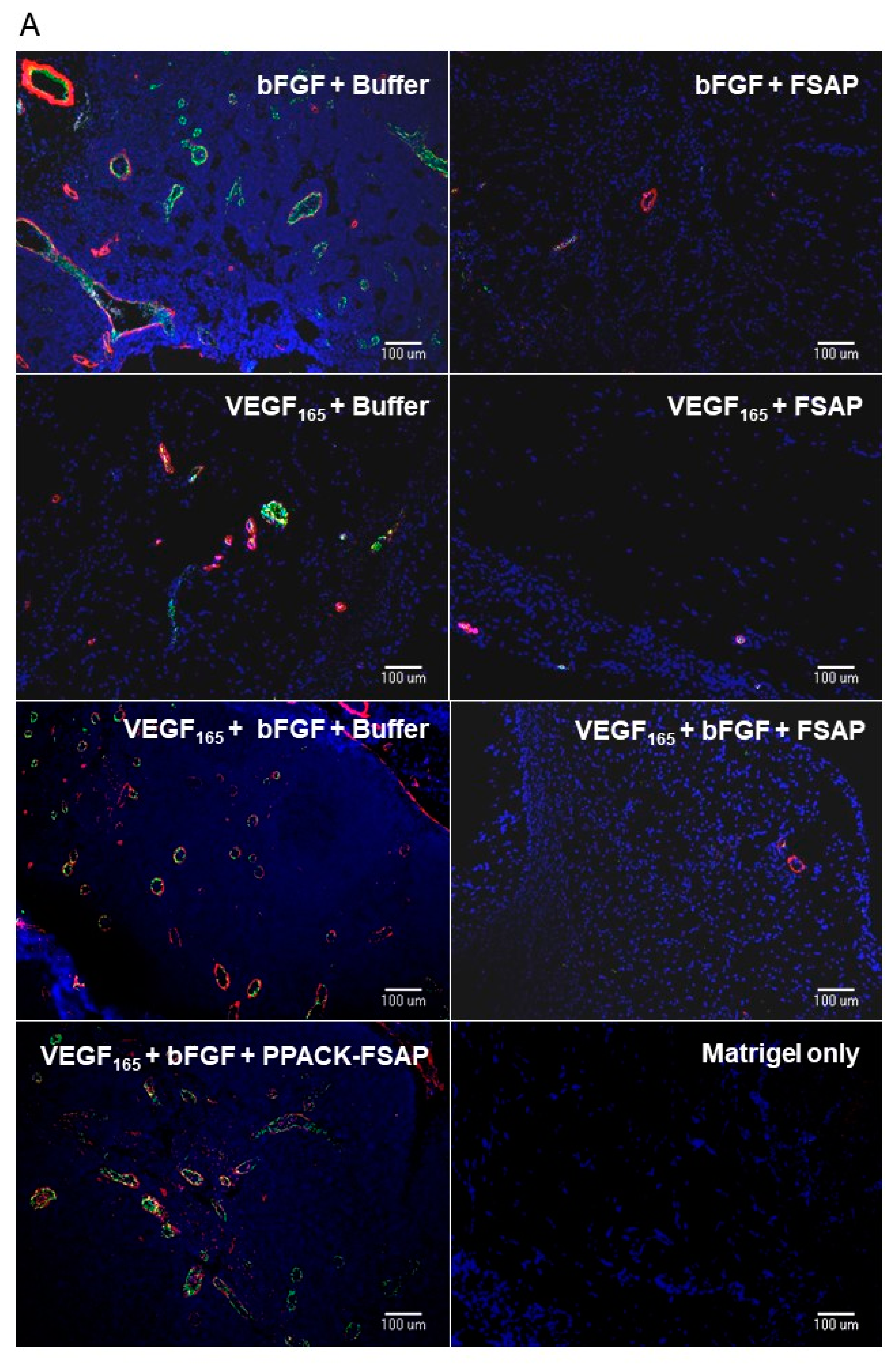 Cells 08 01396 g007a