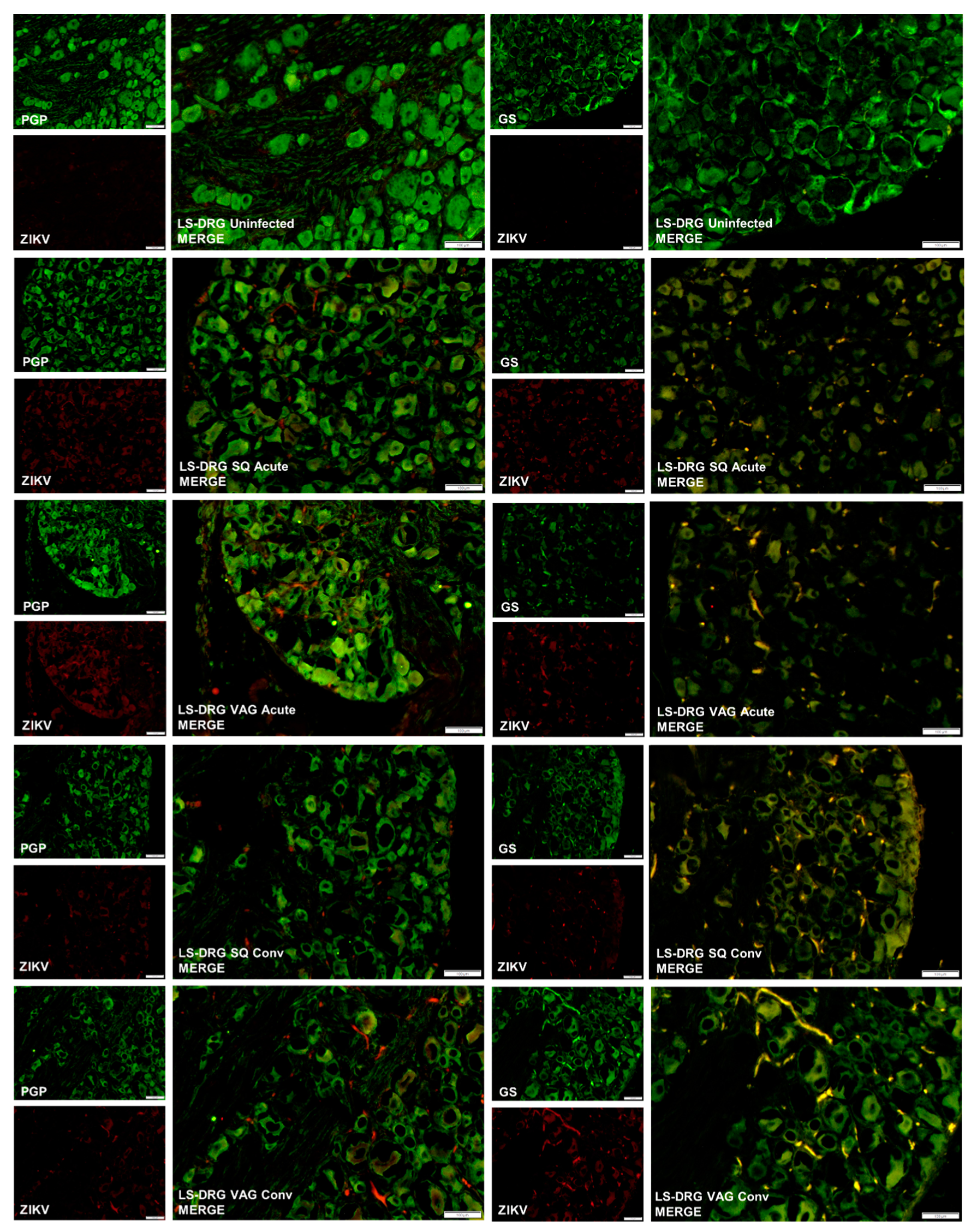 Cells 08 01437 g006 Cells 08 01437 g006