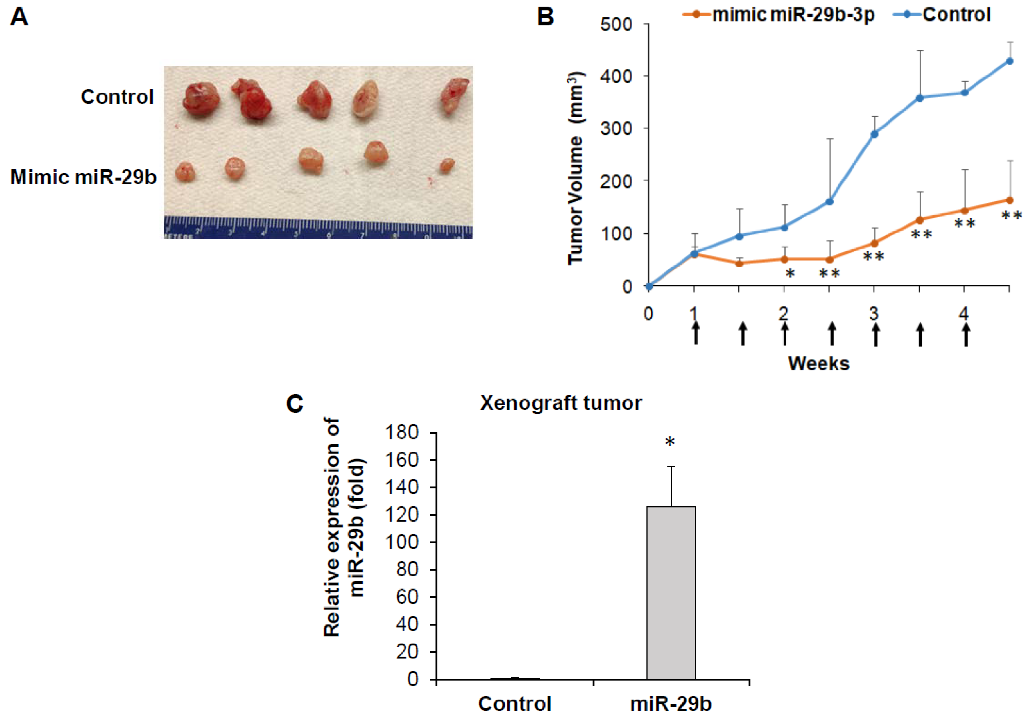 tumor volume prostate cancer