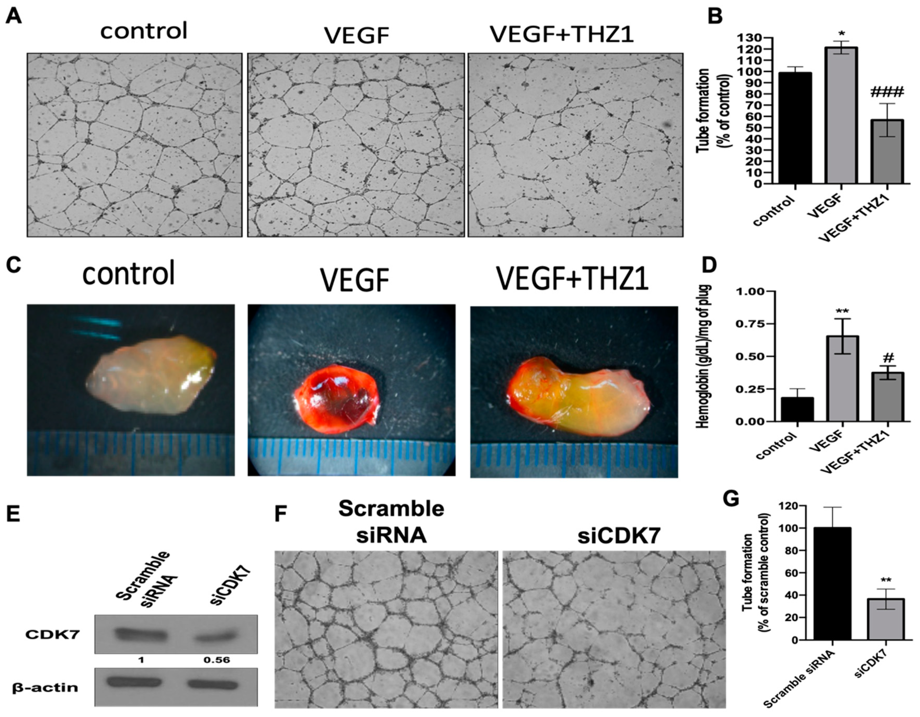 Cells 08 01469 g004