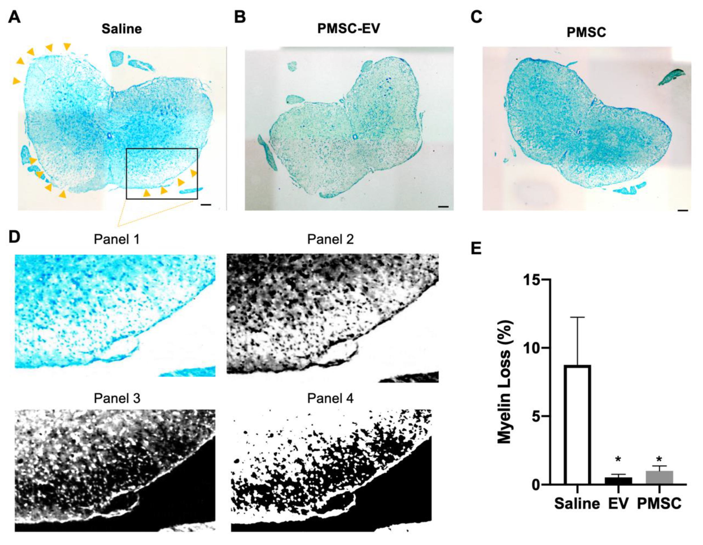 mesenchymal stem cells culture mesenchymal stem cells culture