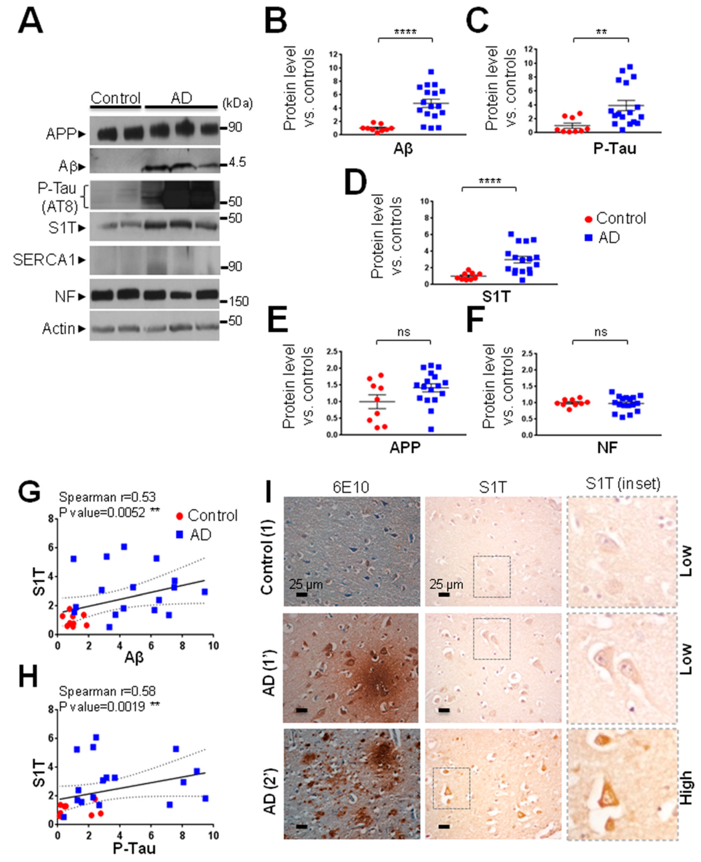 Cells Free Full Text Upregulation Of The Sarco Endoplasmic Reticulum Calcium Atpase 1 Truncated Isoform Plays A Pathogenic Role In Alzheimer S Disease Html