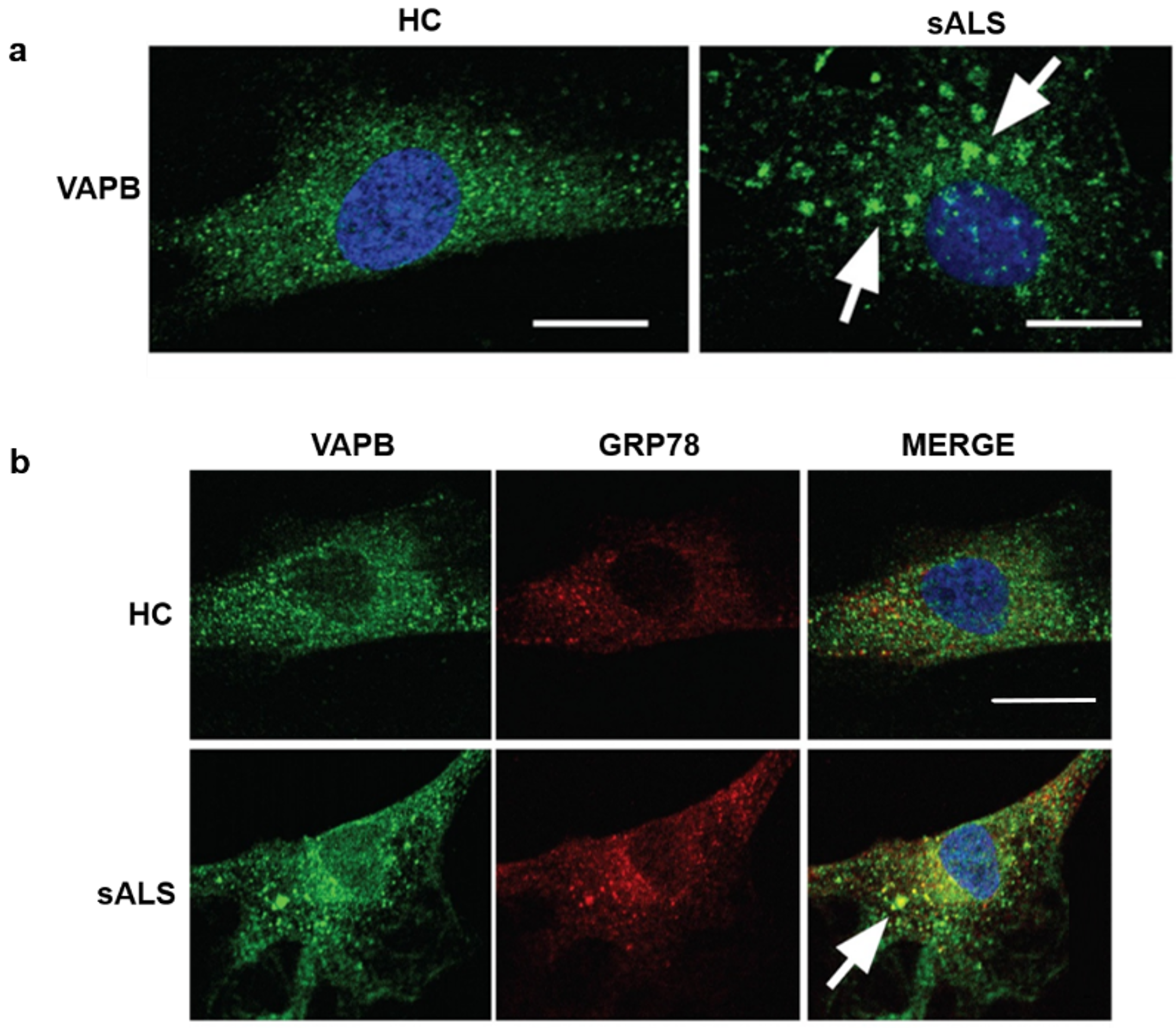 Cells 09 00164 g004 550