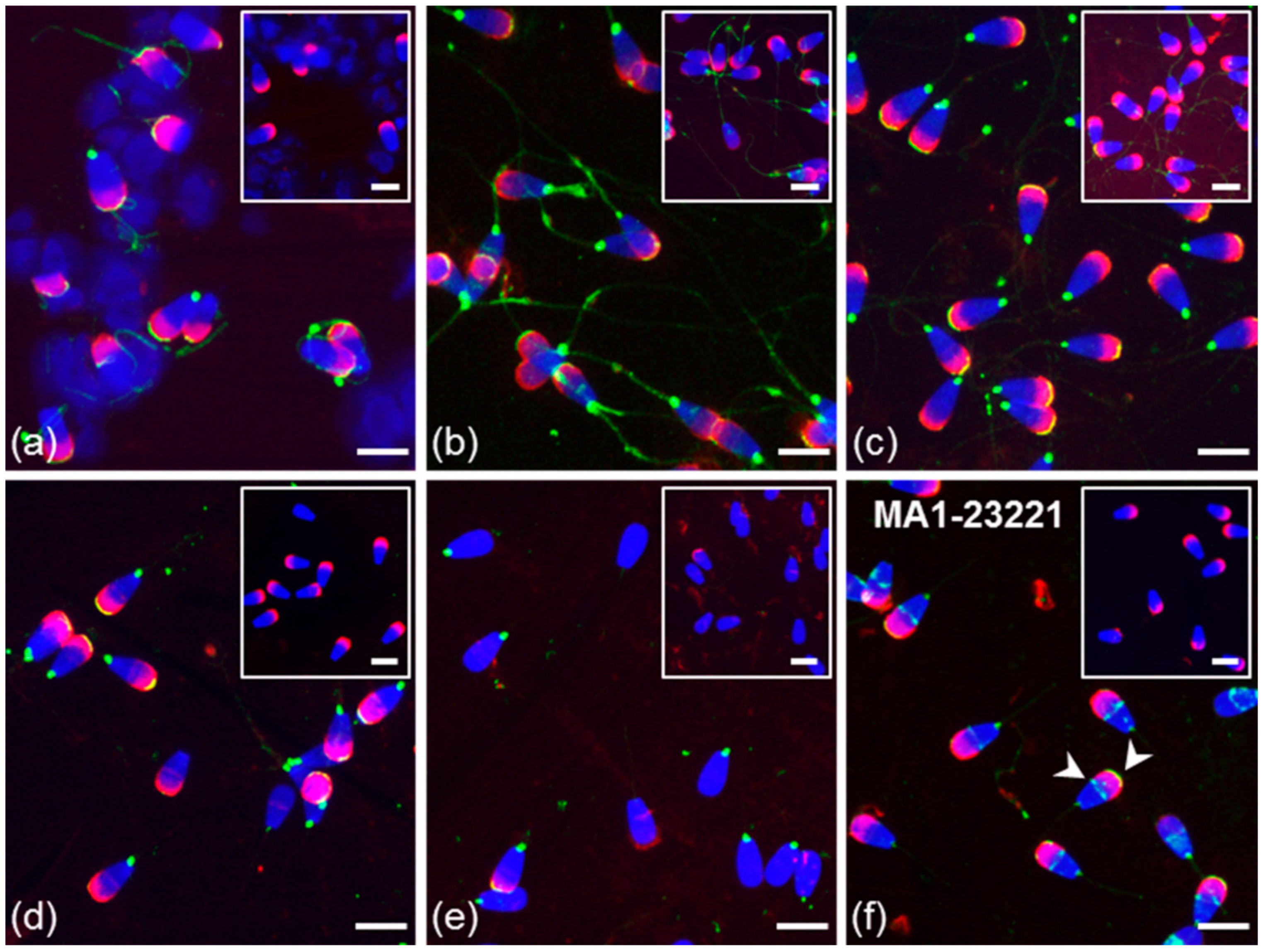 Cells Free Full Text Missing Information From The Estrogen Receptor Puzzle Where Are They Localized In Bull Reproductive Tissues And Spermatozoa Html