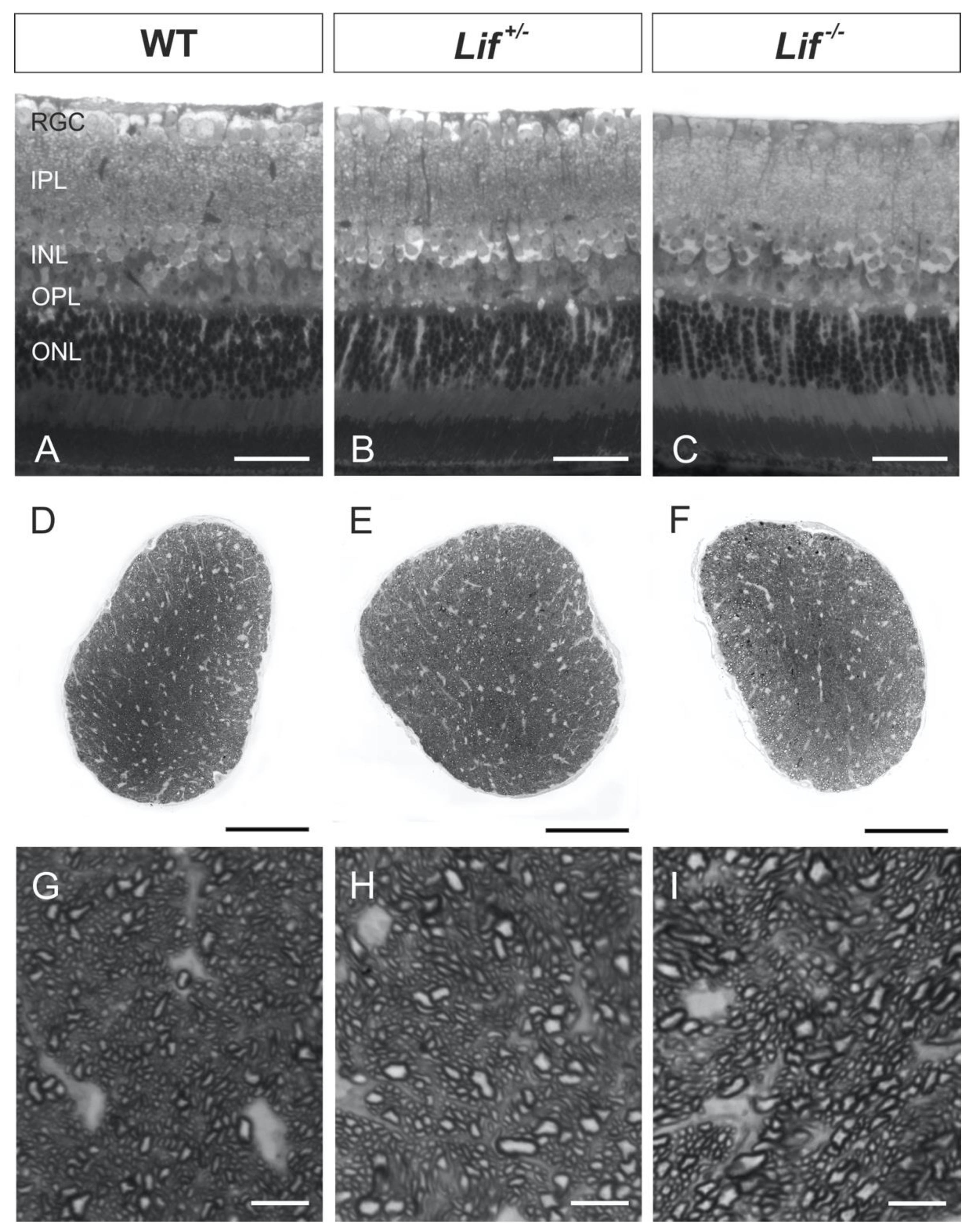 Cells Free Full Text Norrin Protects Retinal Ganglion Cells From Excitotoxic Damage Via The Induction Of Leukemia Inhibitory Factor Html