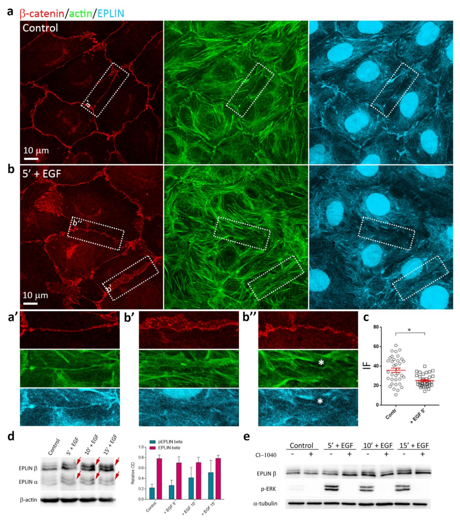 Cells | Free Full-Text | Early Events in Actin Cytoskeleton Dynamics