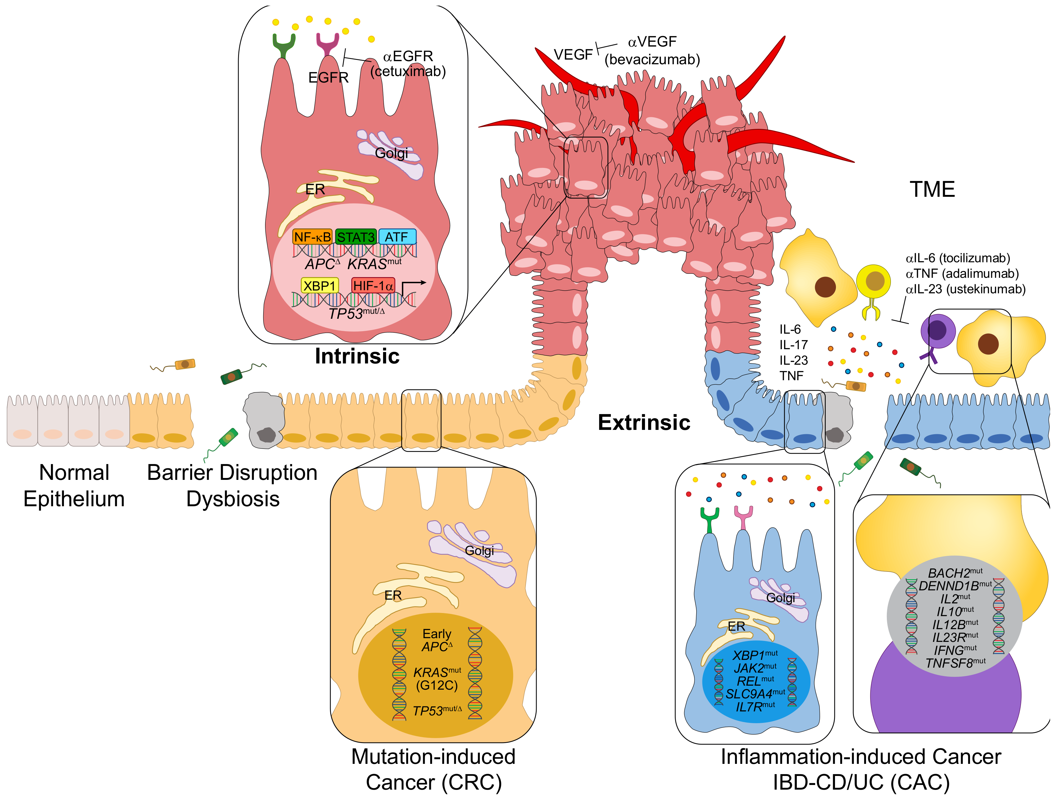 colorectal cancer pathogenesis