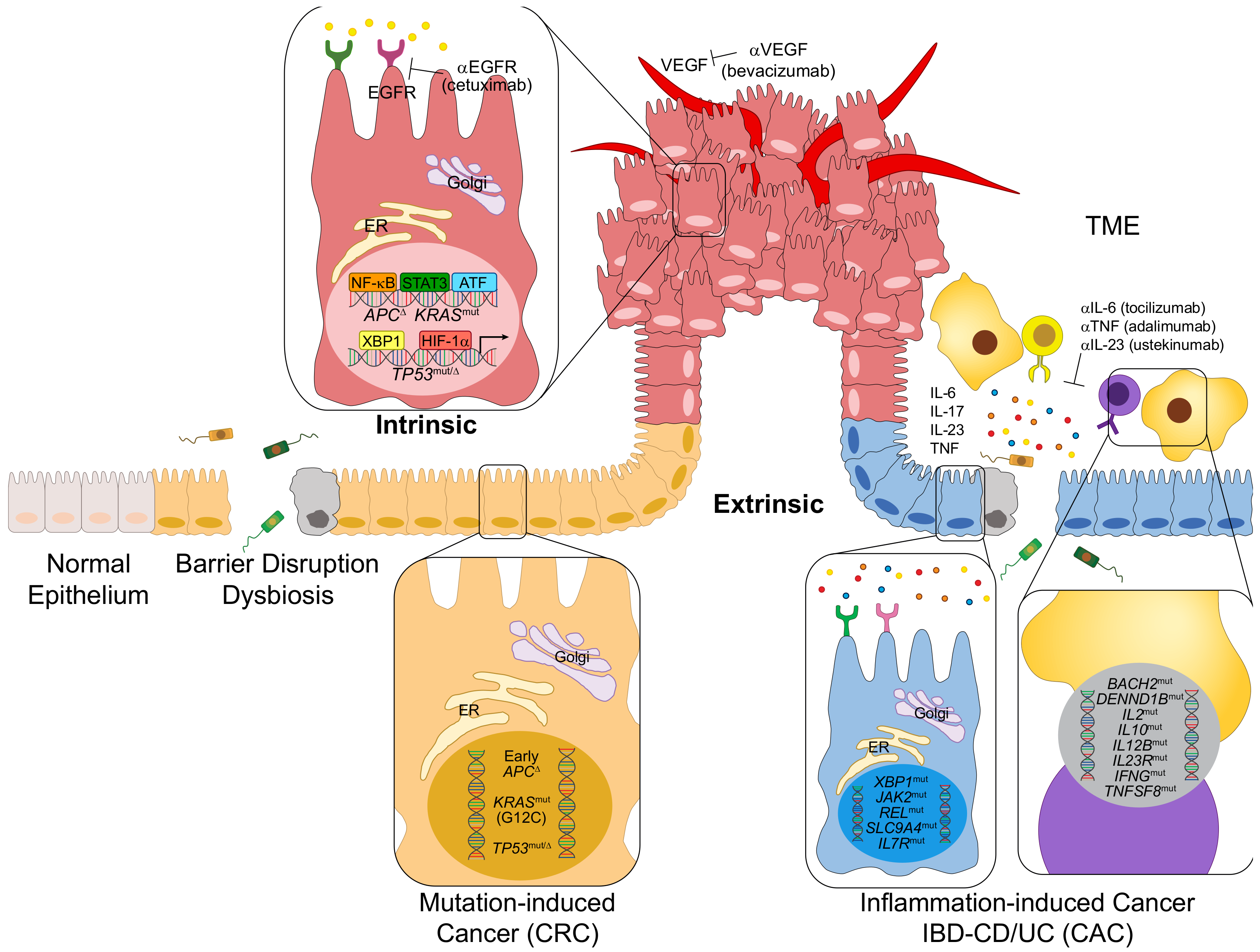 colorectal cancer pathogenesis)