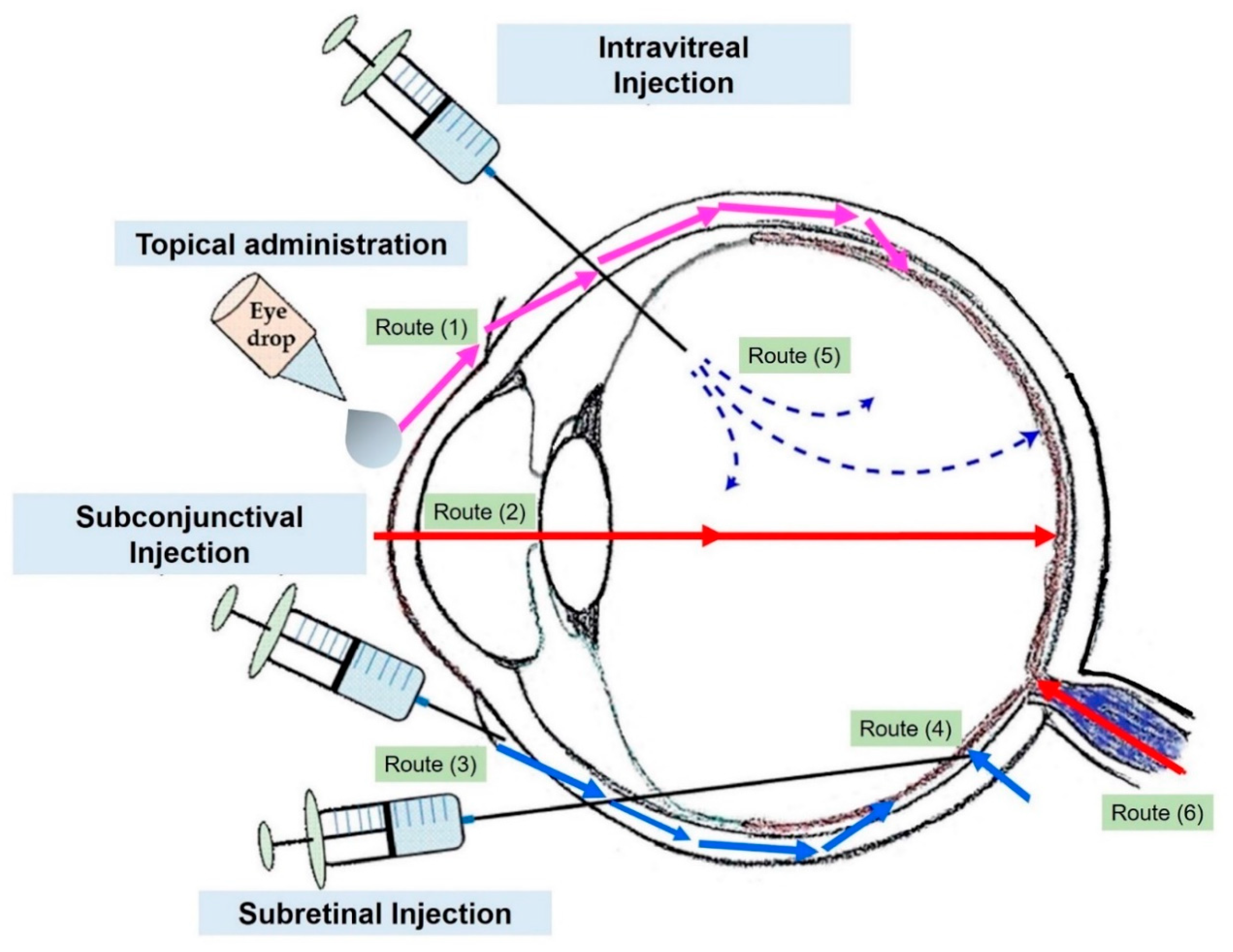 Injection Routes Of Administration