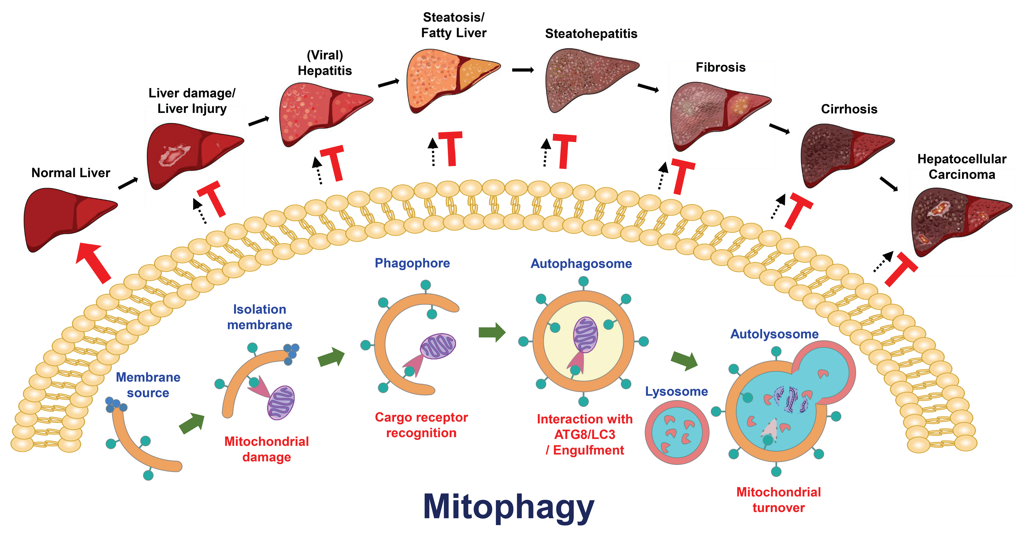 Cells | Free Full-Text | Mitophagy in the Pathogenesis of Liver 