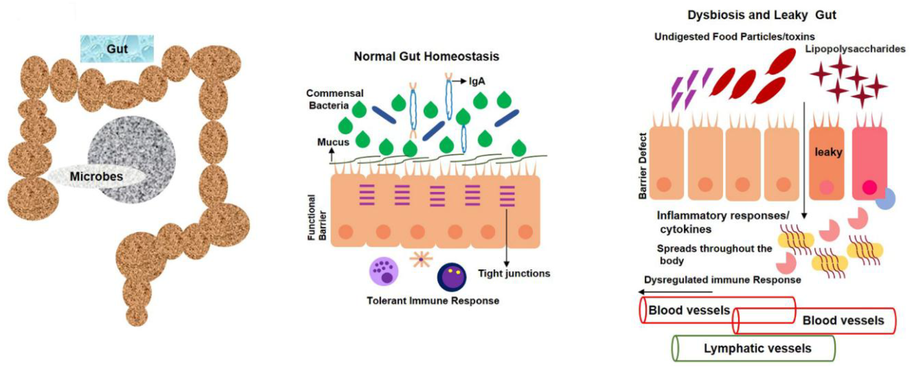 Cells | Free Full-Text | Gut Microbiota, Its Role in Induction of 