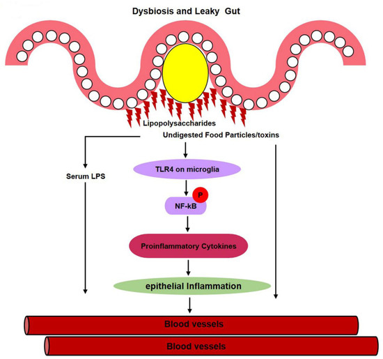 Gut Microbiota, Its Role in Induction of Alzheimer's Disease