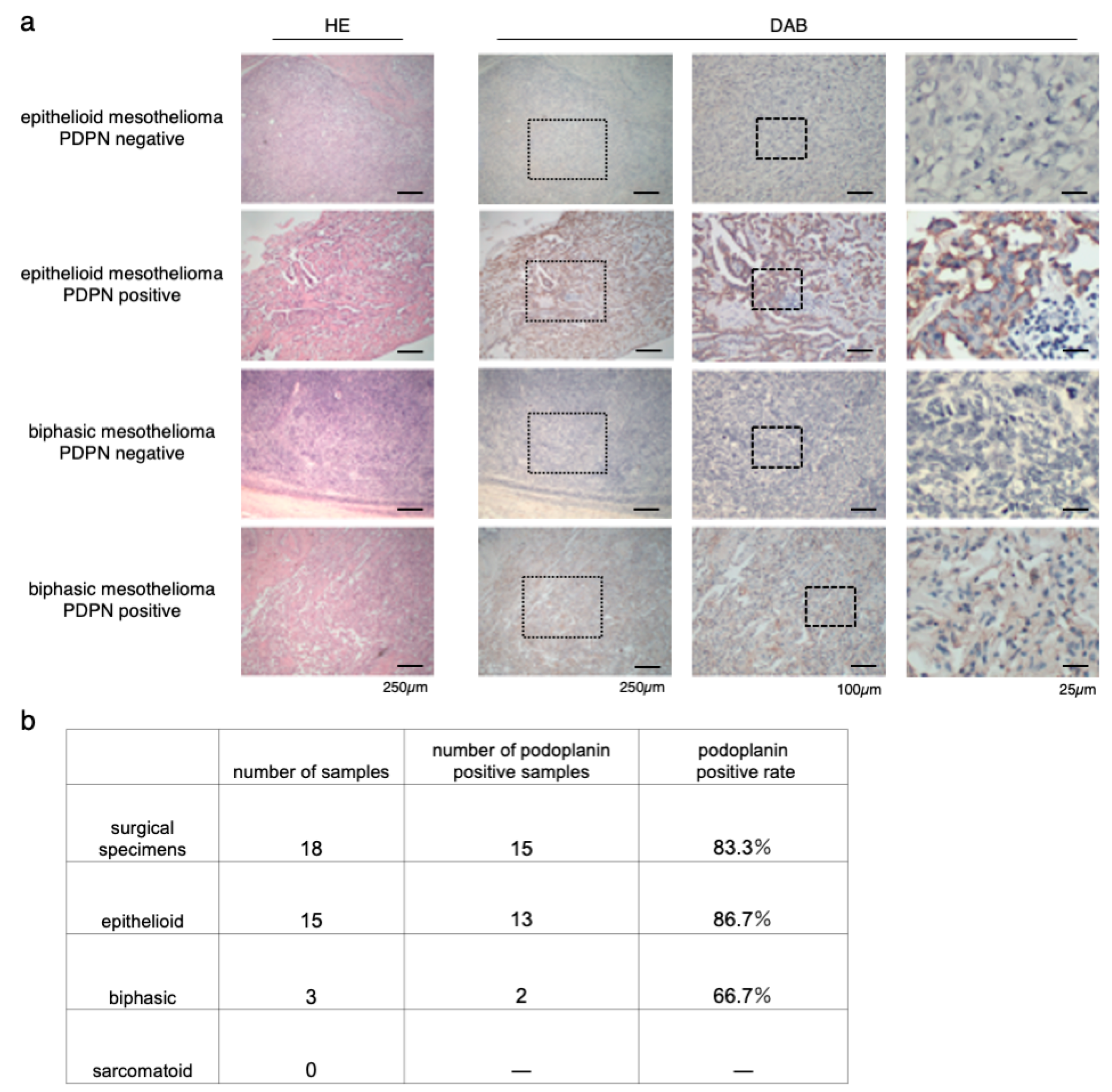 sign guidelines mesothelioma