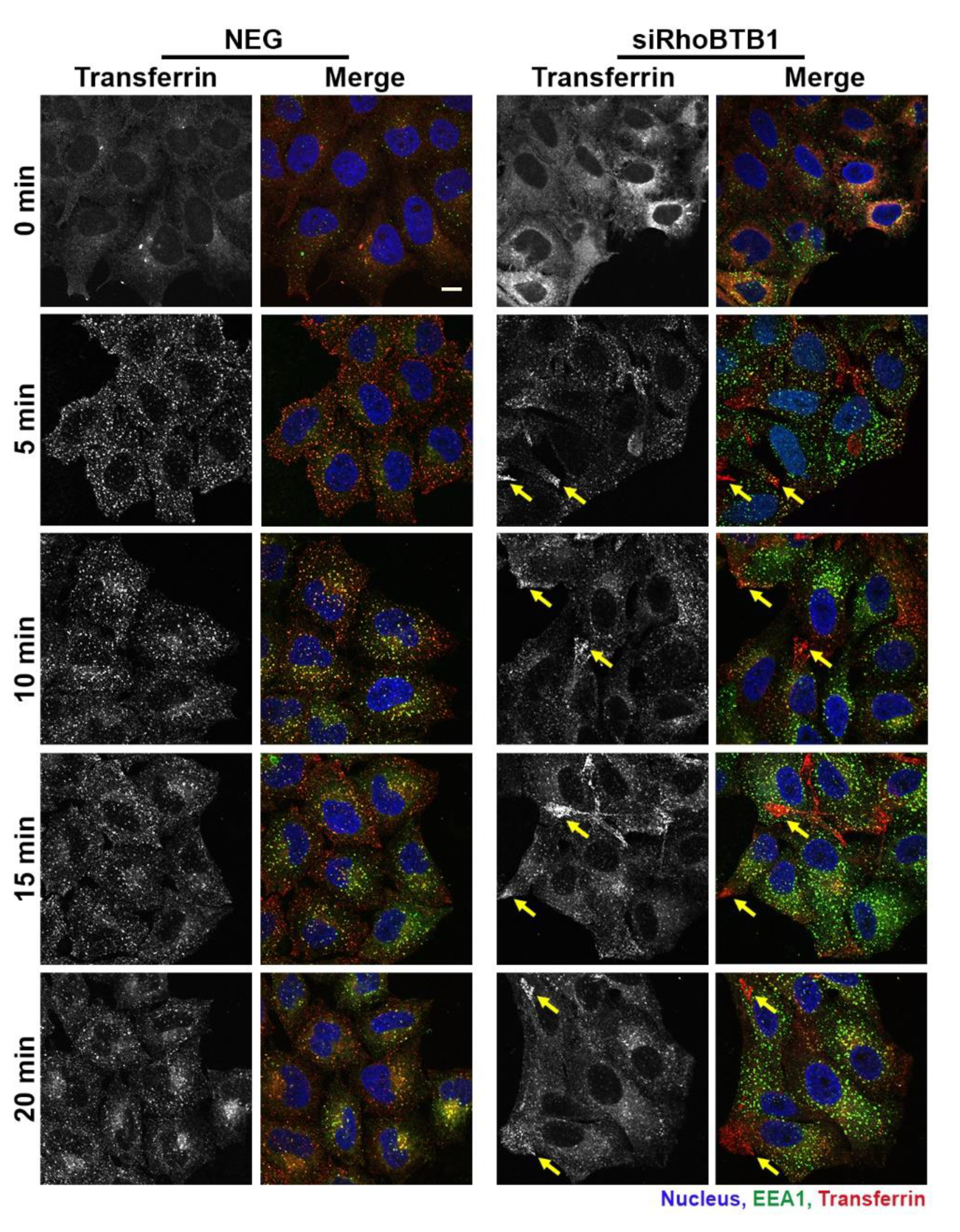 Cells 09 01089 g007
