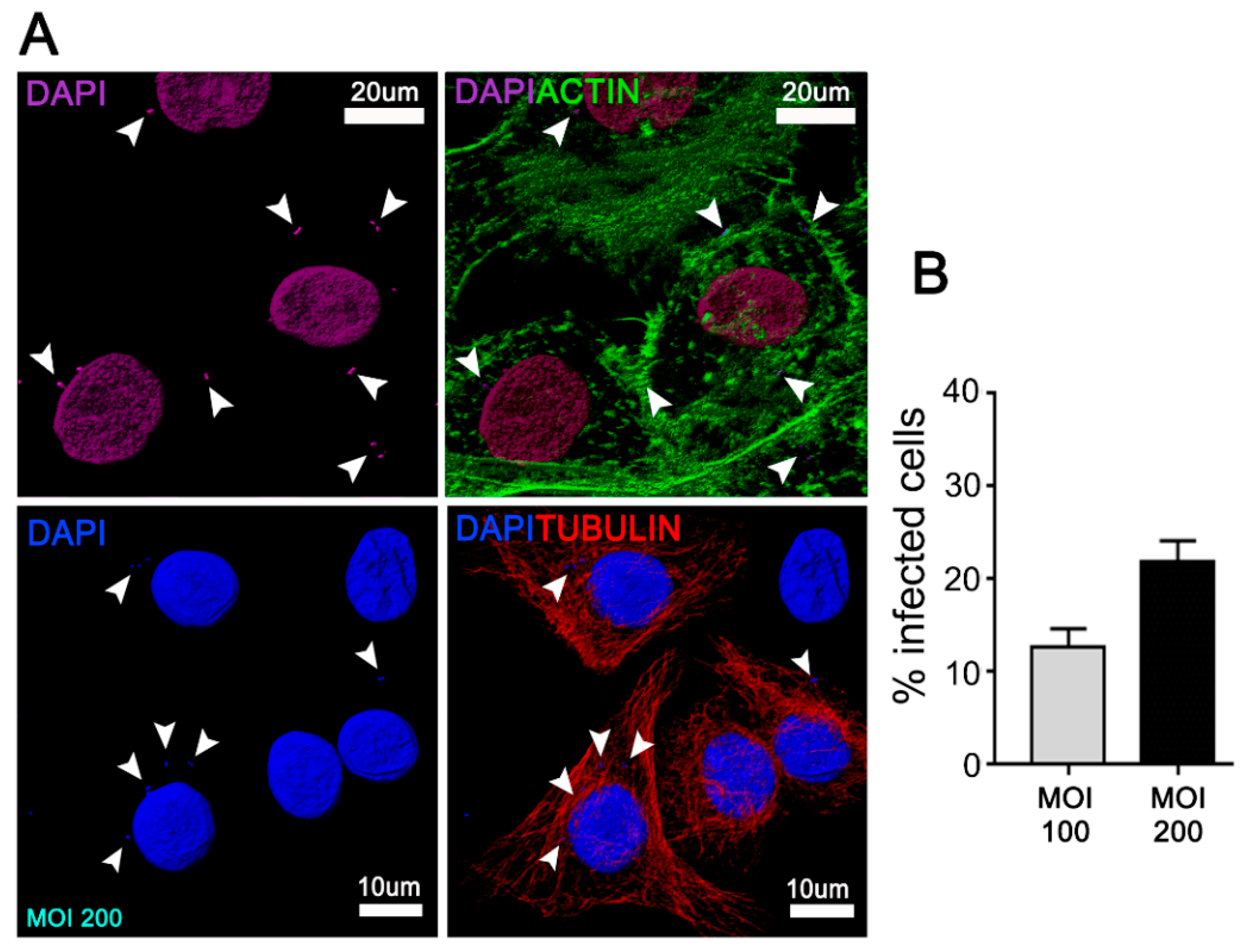 Cells Free Full Text Aggregatibacter Actinomycetemcomitans Induces Autophagy In Human Junctional Epithelium Keratinocytes Html