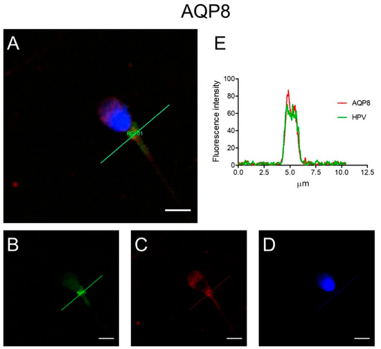 Cells Free FullText HPV Infection Affects Human Sperm