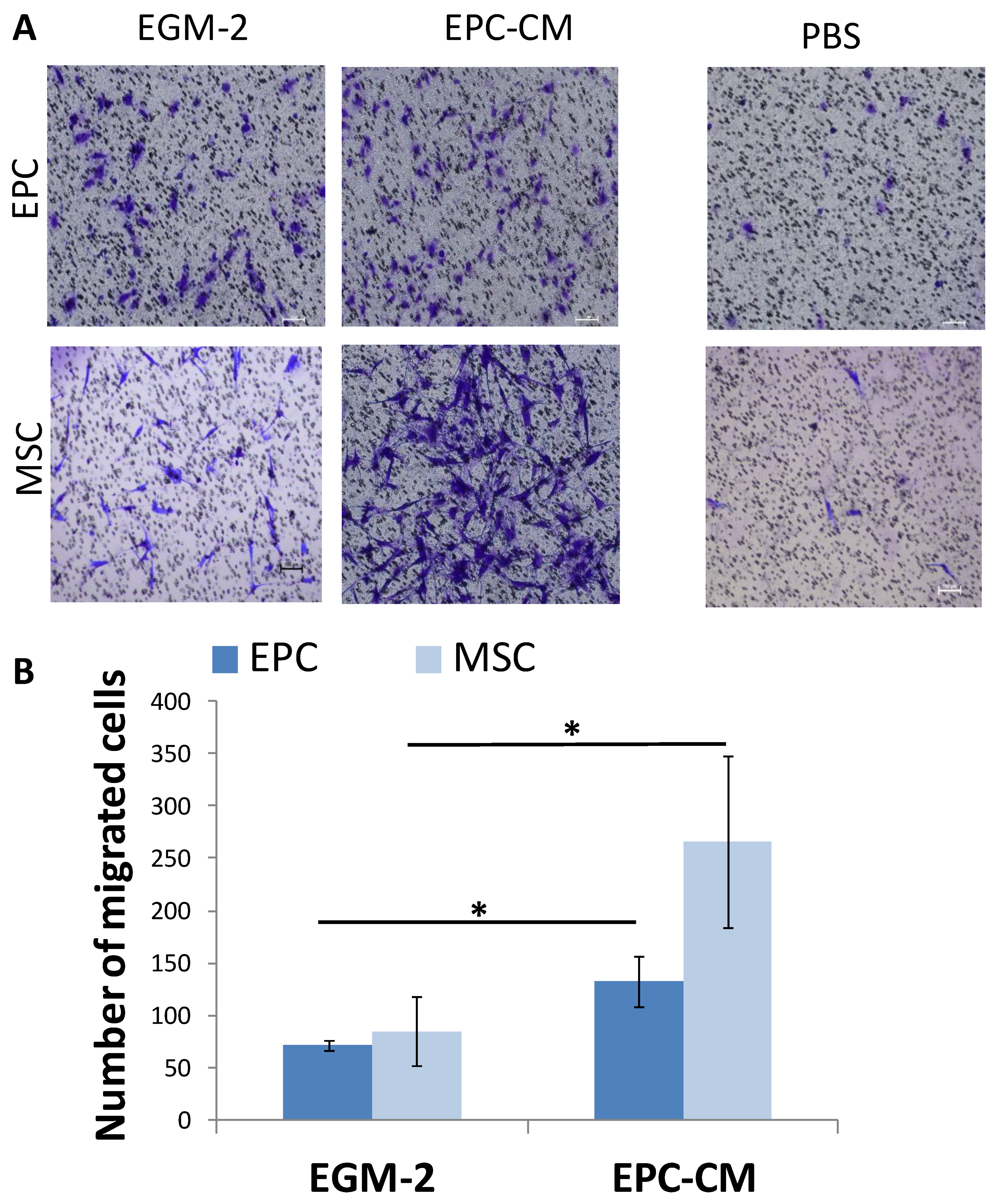 Cells Free Full Text The Paracrine Role Of Endothelial Cells In Bone Formation Via Cxcr4 Sdf 1 Pathway Cells Free Full Text The Paracrine Role Of Endothelial Cells In Bone Formation Via Cxcr4 Sdf 1 Pathway