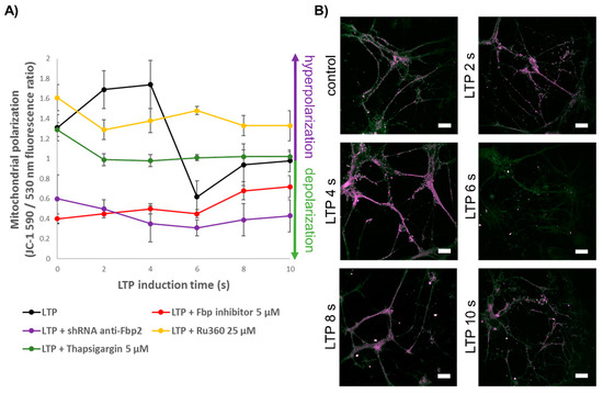 Fructose 1,6-Bisphosphatase 2 Plays a Crucial Role in the