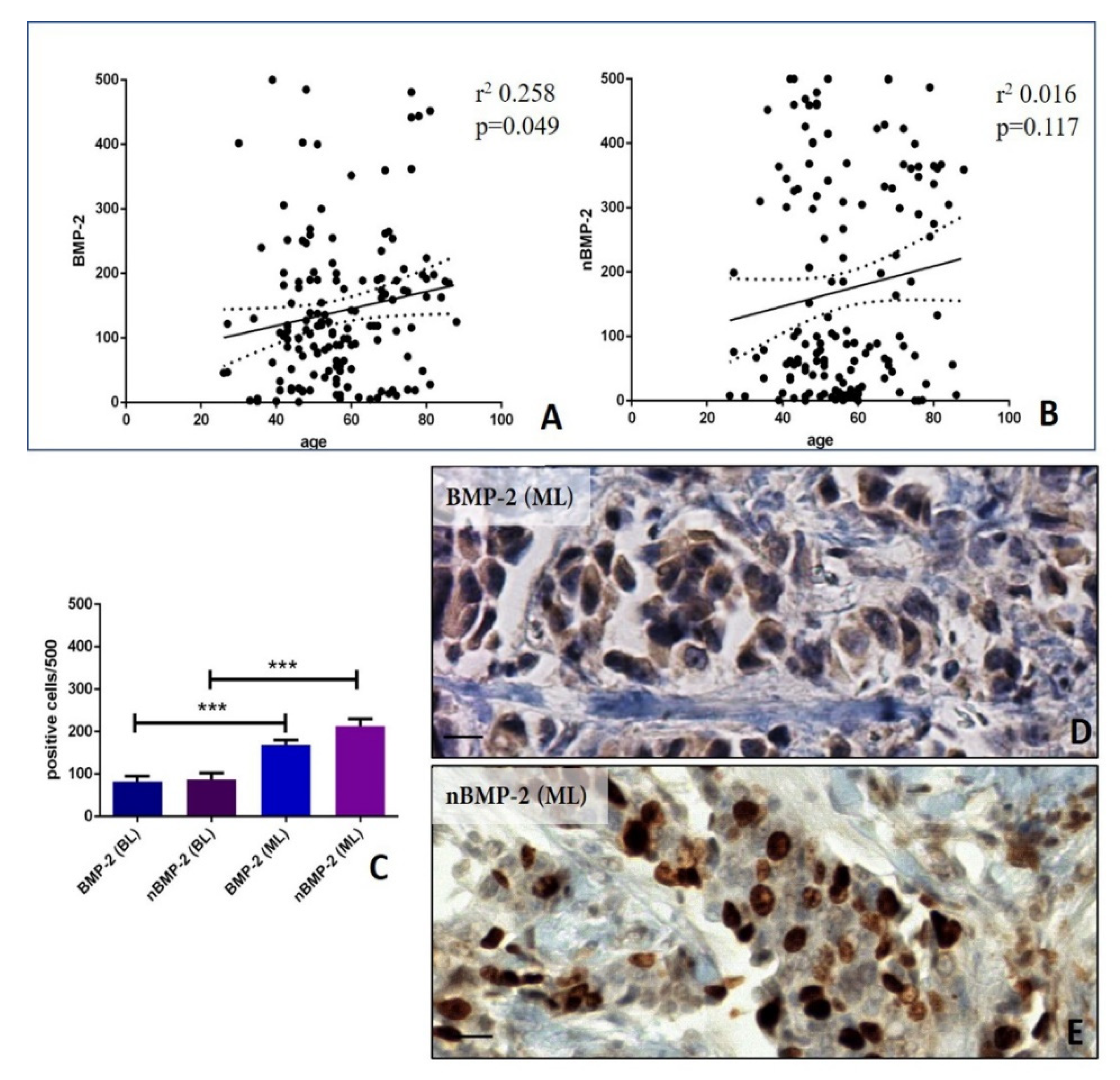 Cells Free Full Text Bmp 2 Variants In Breast Epithelial To Mesenchymal Transition And Microcalcifications Origin Html Cells Free Full Text Bmp 2 Variants In Breast Epithelial To Mesenchymal Transition And Microcalcifications Origin Html