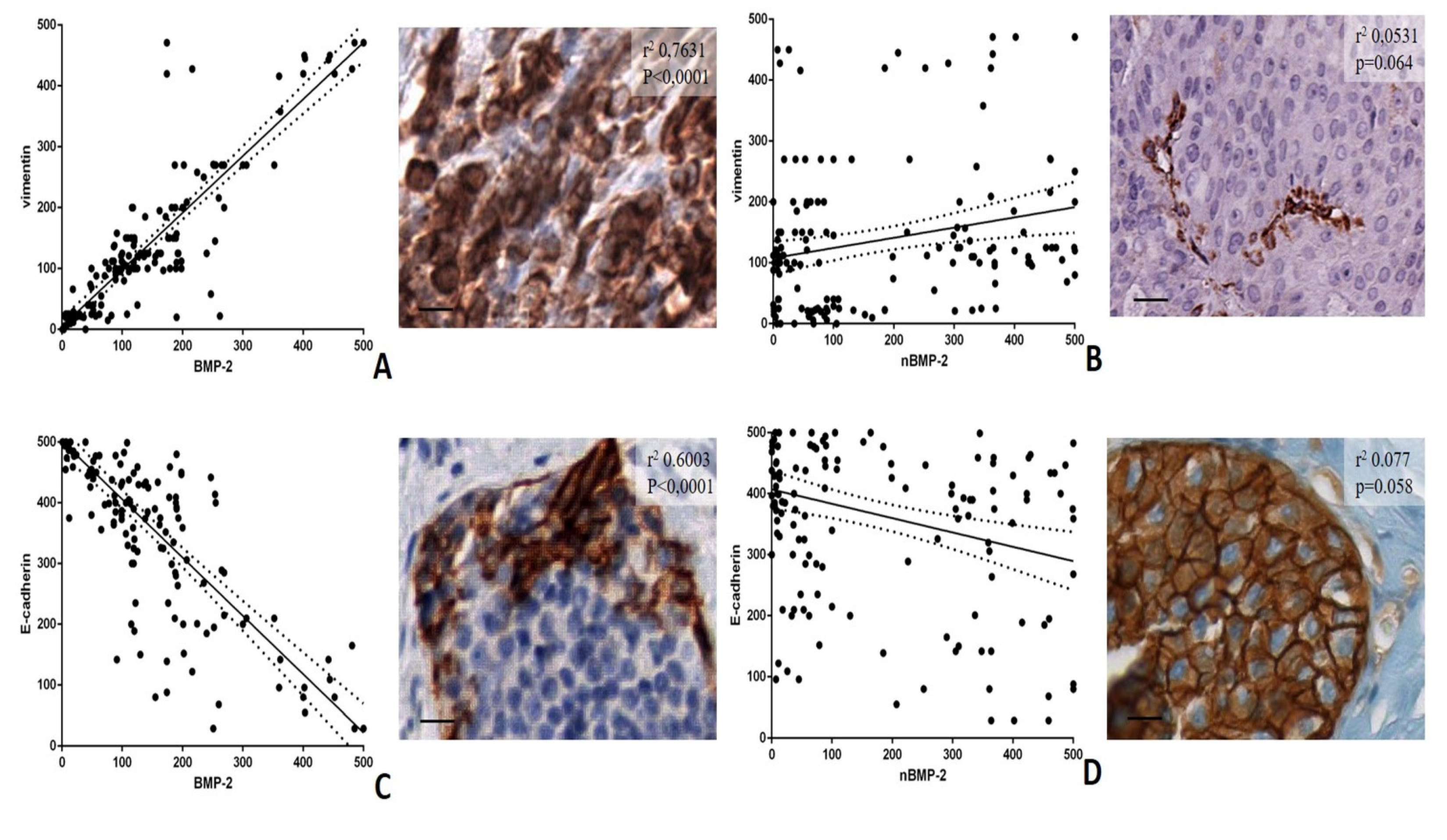 Cells Free Full Text Bmp 2 Variants In Breast Epithelial To Mesenchymal Transition And Microcalcifications Origin Html Cells Free Full Text Bmp 2 Variants In Breast Epithelial To Mesenchymal Transition And Microcalcifications Origin Html