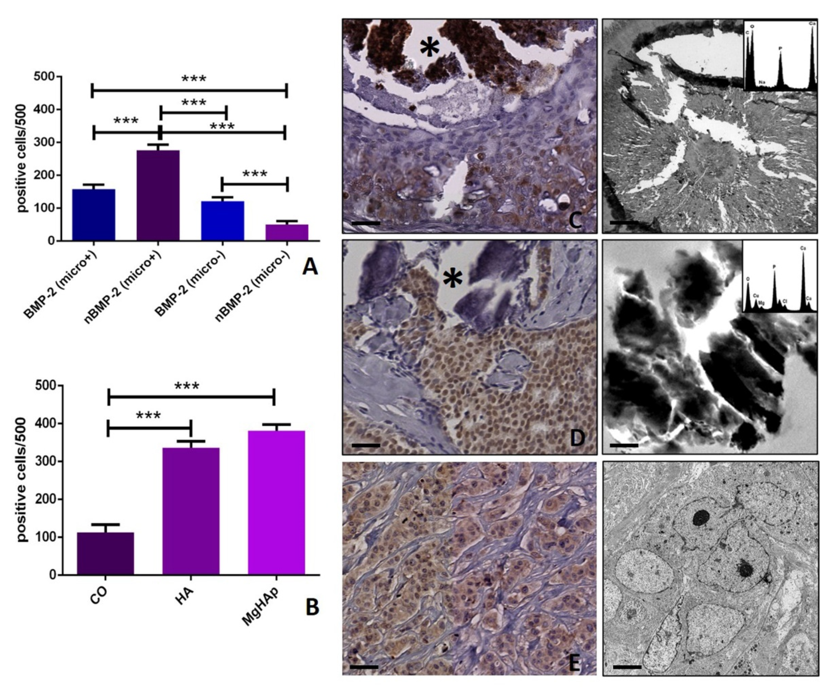 Cells Free Full Text Bmp 2 Variants In Breast Epithelial To Mesenchymal Transition And Microcalcifications Origin Html Cells Free Full Text Bmp 2 Variants In Breast Epithelial To Mesenchymal Transition And Microcalcifications Origin Html