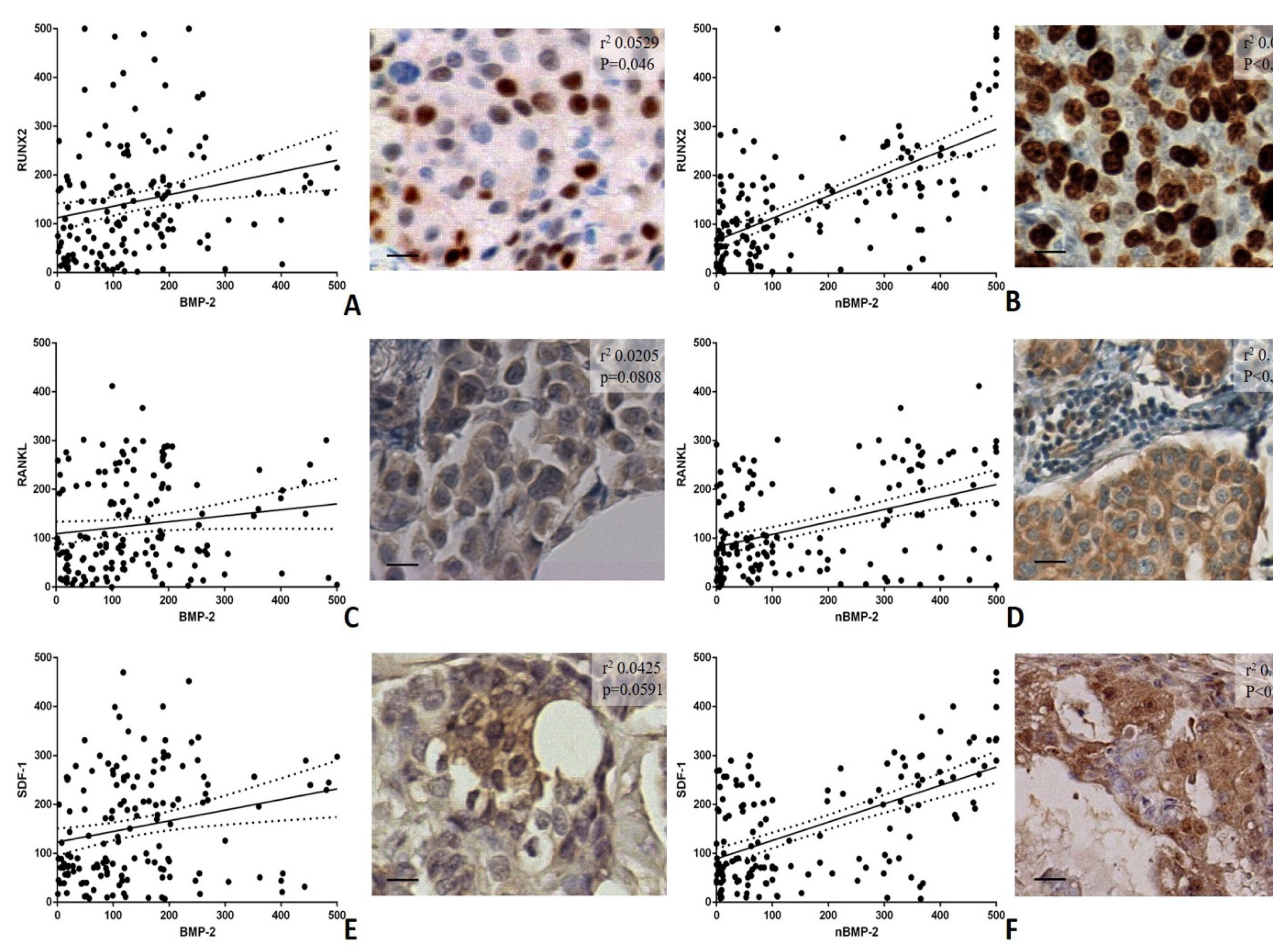 Cells Free Full Text Bmp 2 Variants In Breast Epithelial To Mesenchymal Transition And Microcalcifications Origin Html Cells Free Full Text Bmp 2 Variants In Breast Epithelial To Mesenchymal Transition And Microcalcifications Origin Html