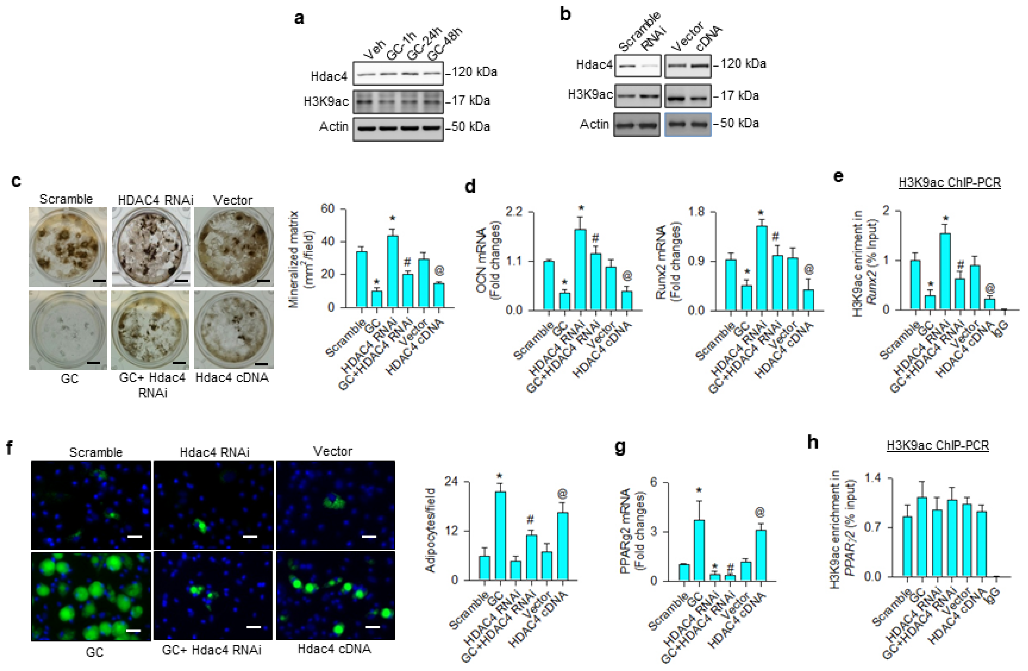 Cells Free Full Text Bromodomain Protein Brd4 Accelerates Glucocorticoid Dysregulation Of Bone Mass And Marrow Adiposis By Modulating H3k9 And Foxp1